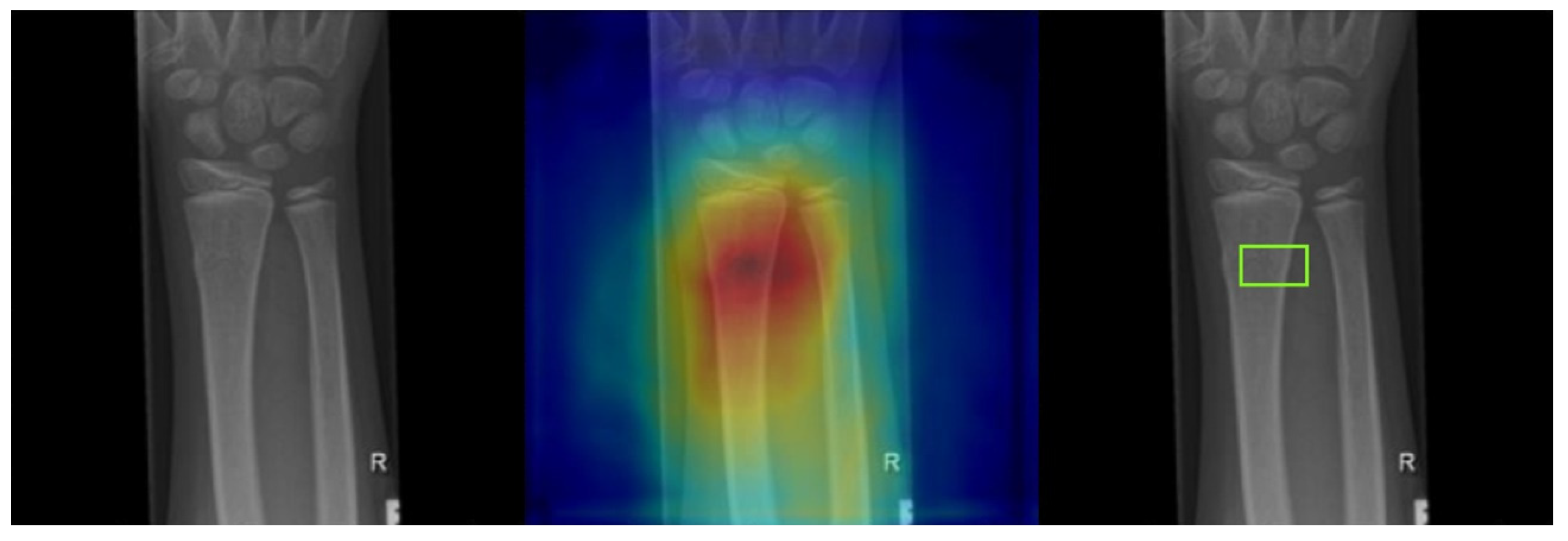 Diagnostics 13 02927 g007