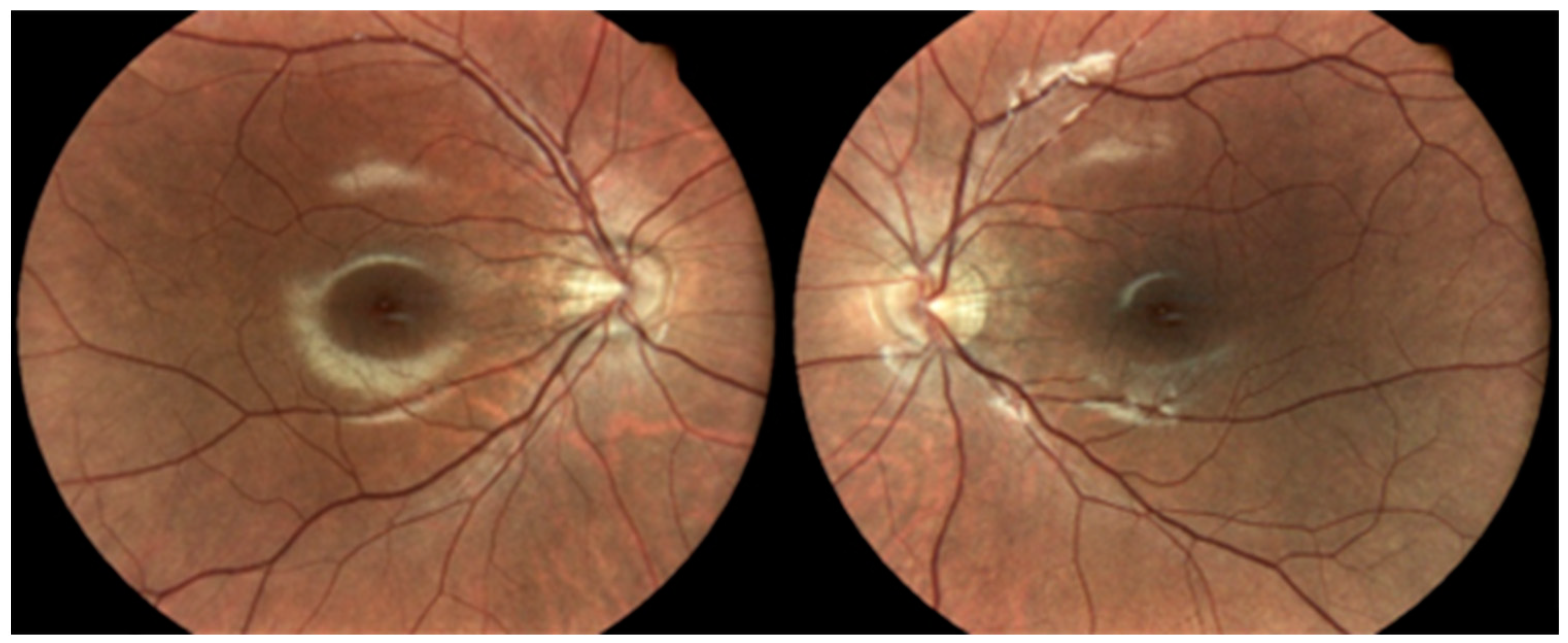 Diagnostics 13 02934 g001 Diagnostics 13 02934 g001