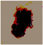 Diagnostics 13 02958 i042