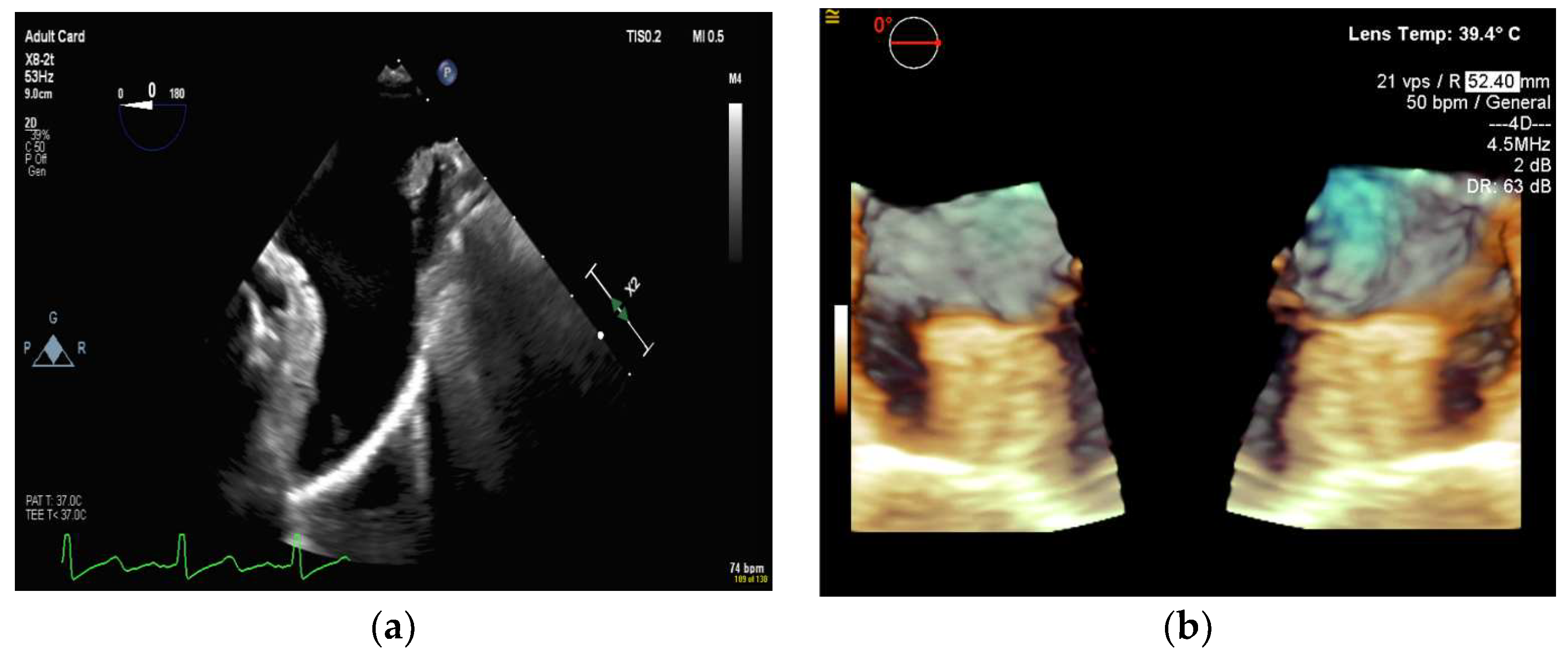 Diagnostics 13 02981 g010 Diagnostics 13 02981 g010