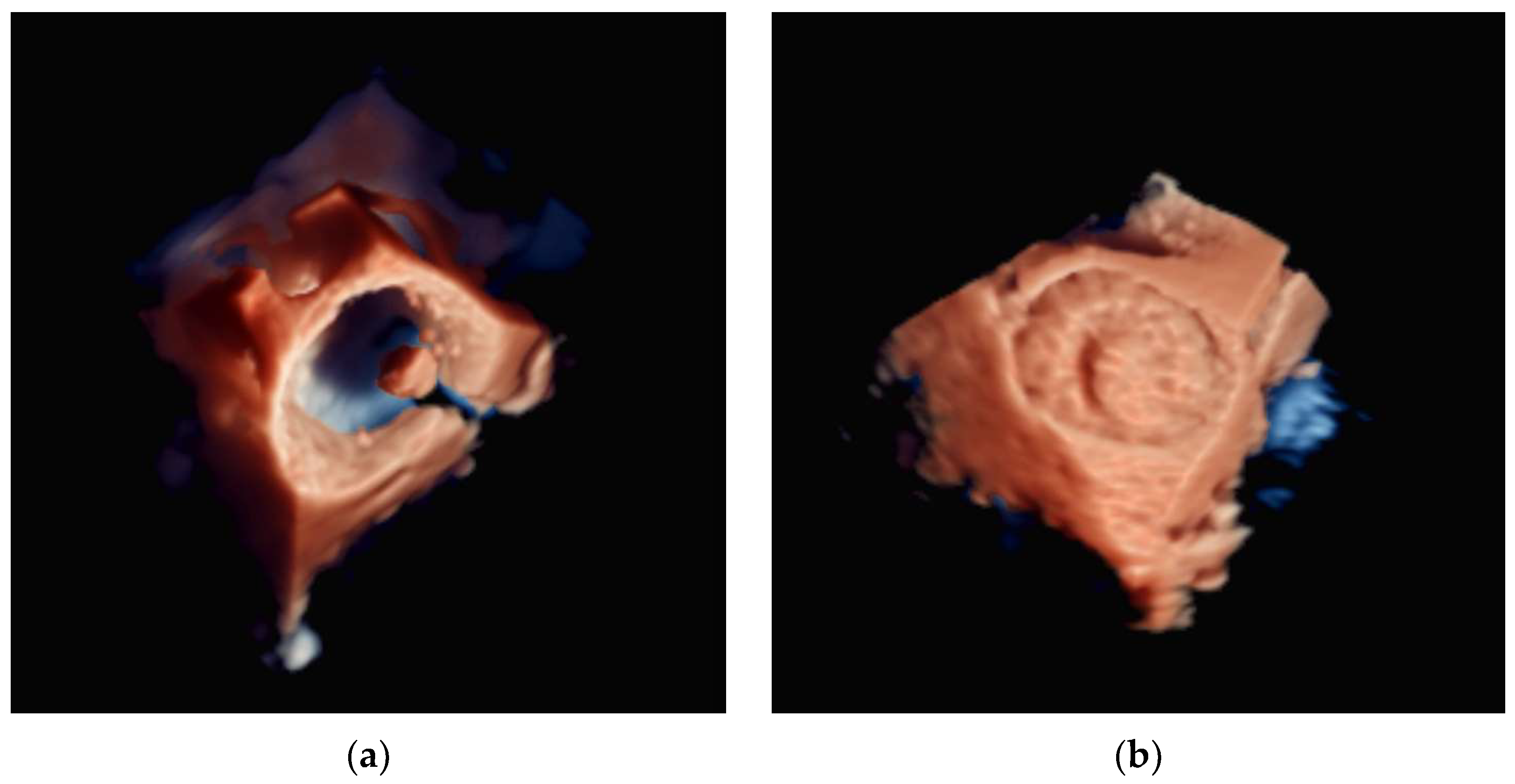 Diagnostics 13 02981 g011 Diagnostics 13 02981 g011