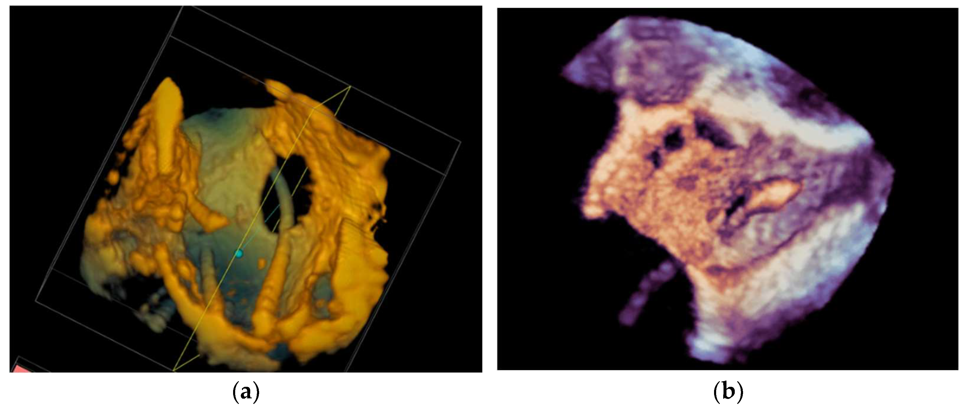 Diagnostics 13 02981 g014 Diagnostics 13 02981 g014