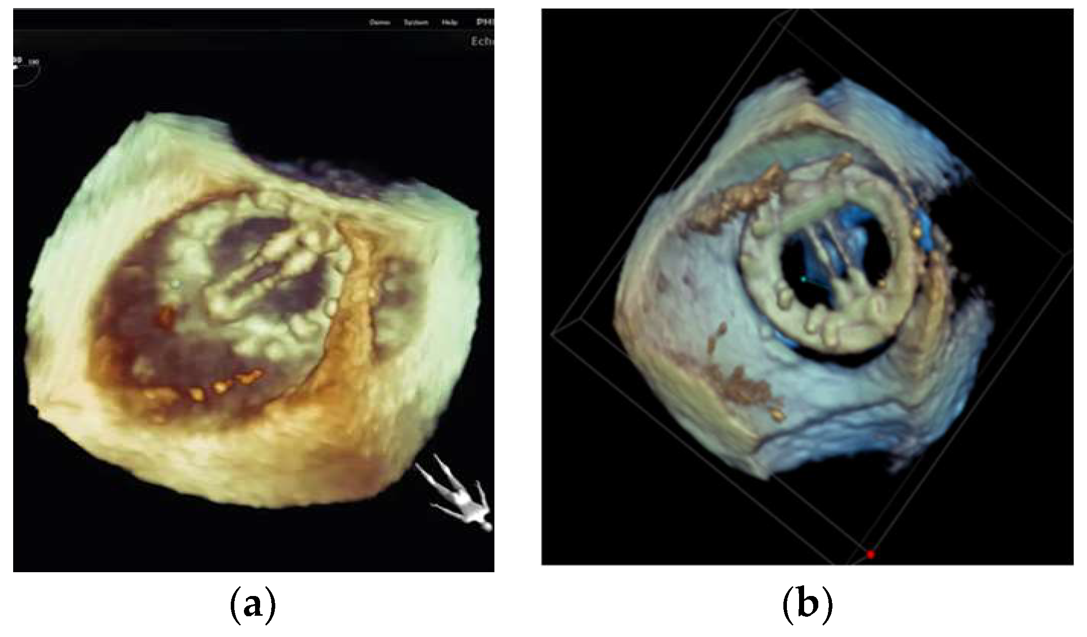 Diagnostics 13 02981 g015 Diagnostics 13 02981 g015