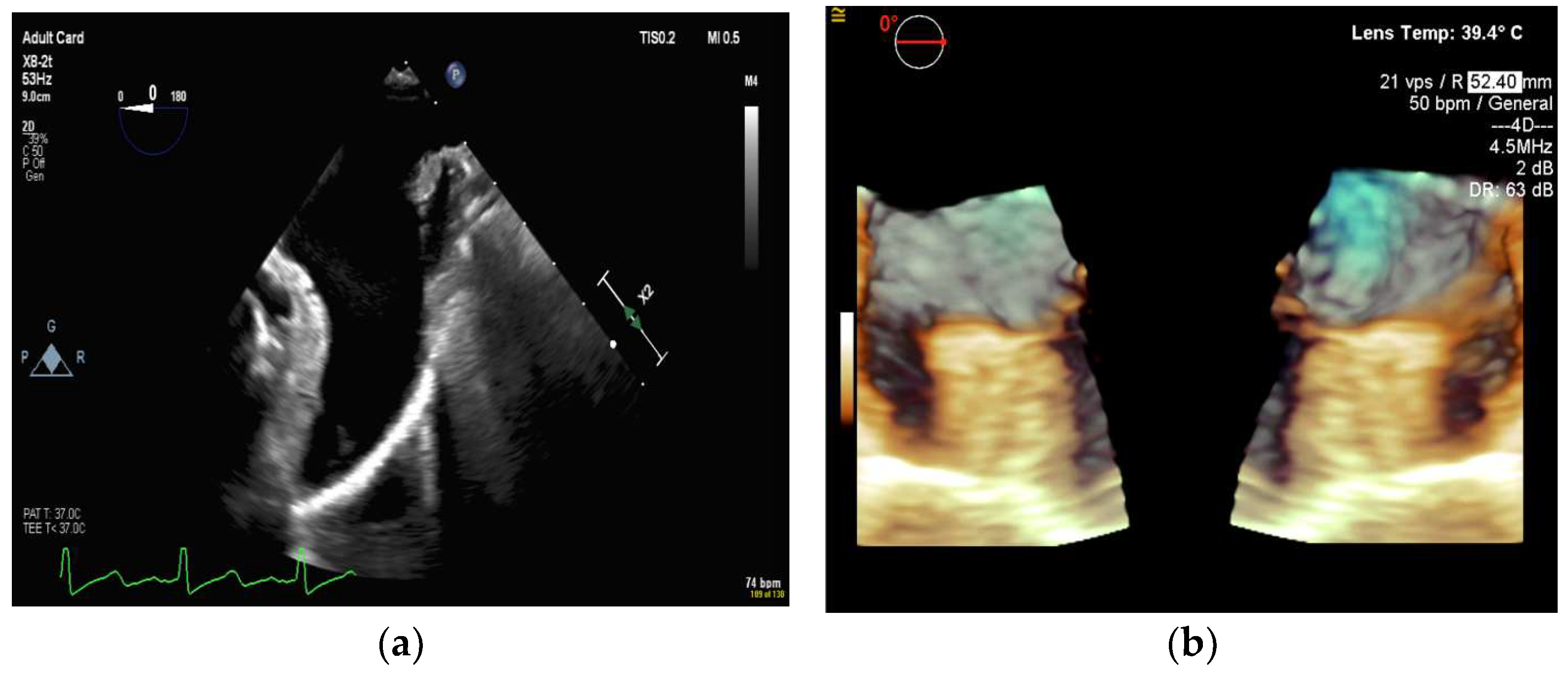 Diagnostics 13 02981 g016a Diagnostics 13 02981 g016a