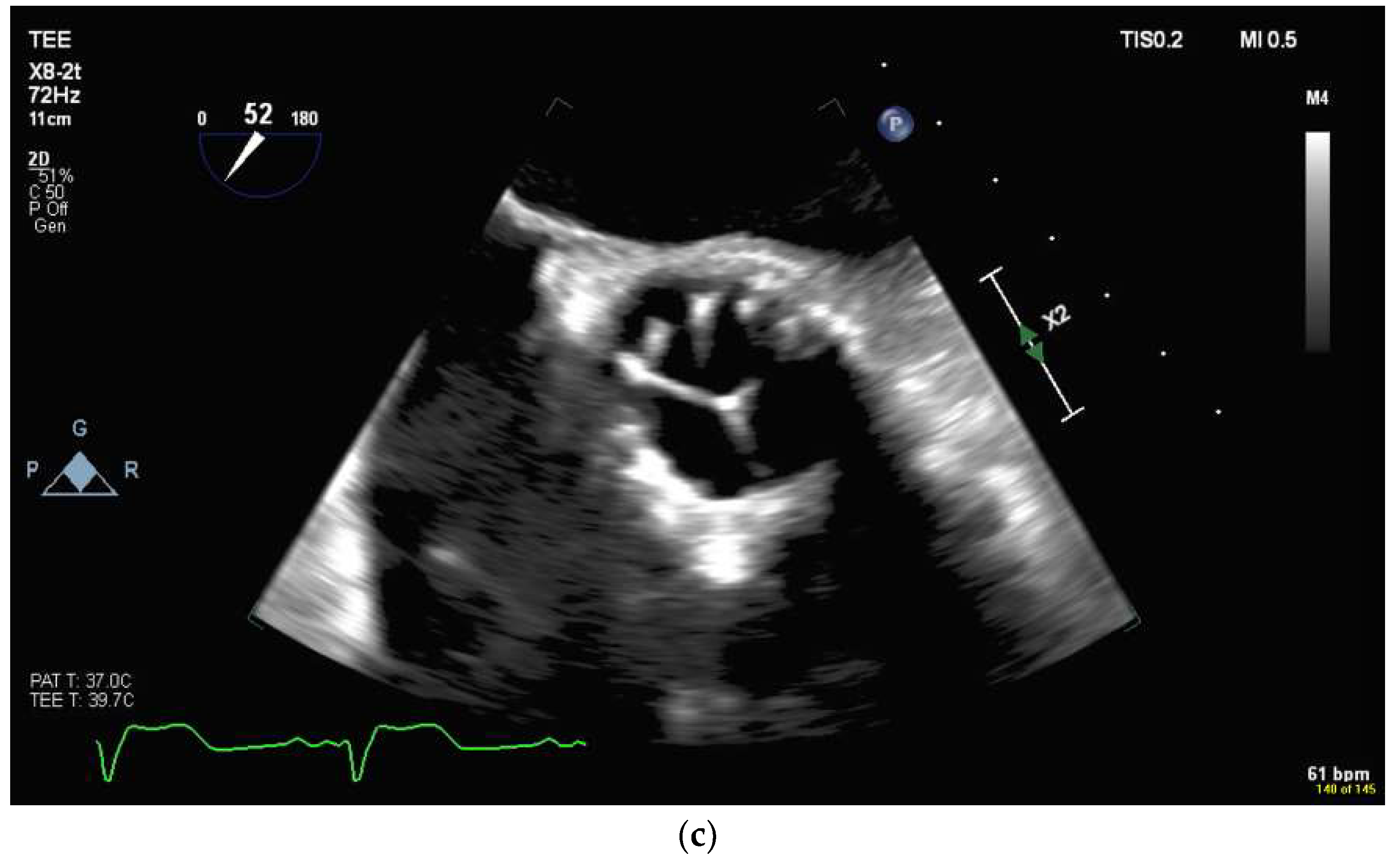 Diagnostics 13 02981 g016b Diagnostics 13 02981 g016b