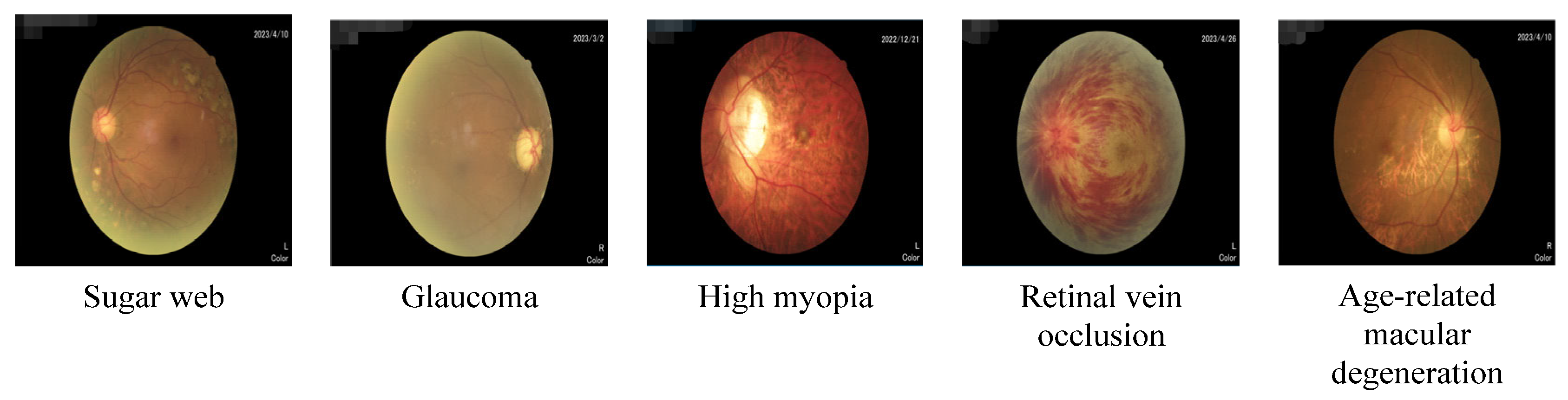 Diagnostics 13 02985 g001