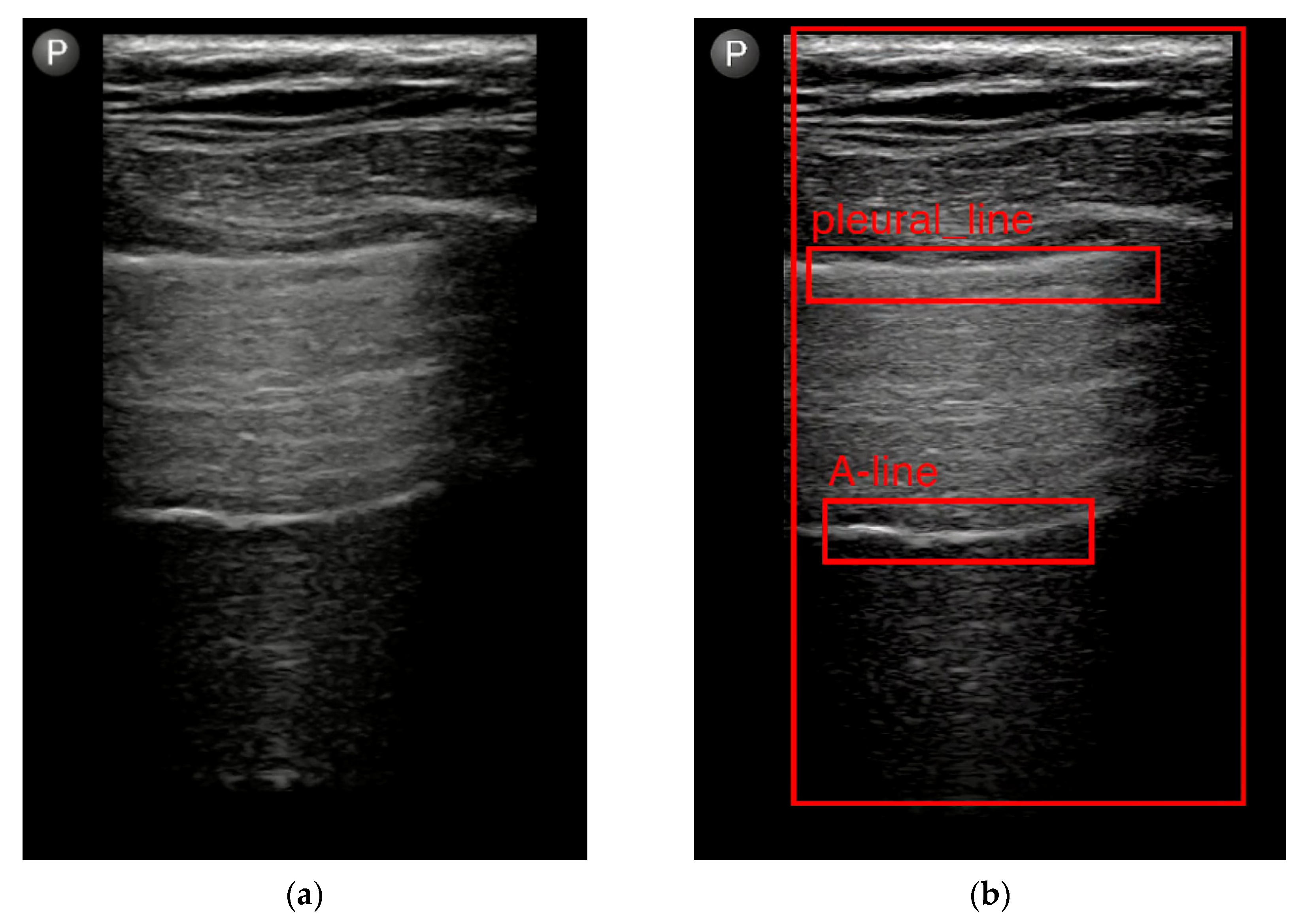 Diagnostics 13 02995 g004 Diagnostics 13 02995 g004
