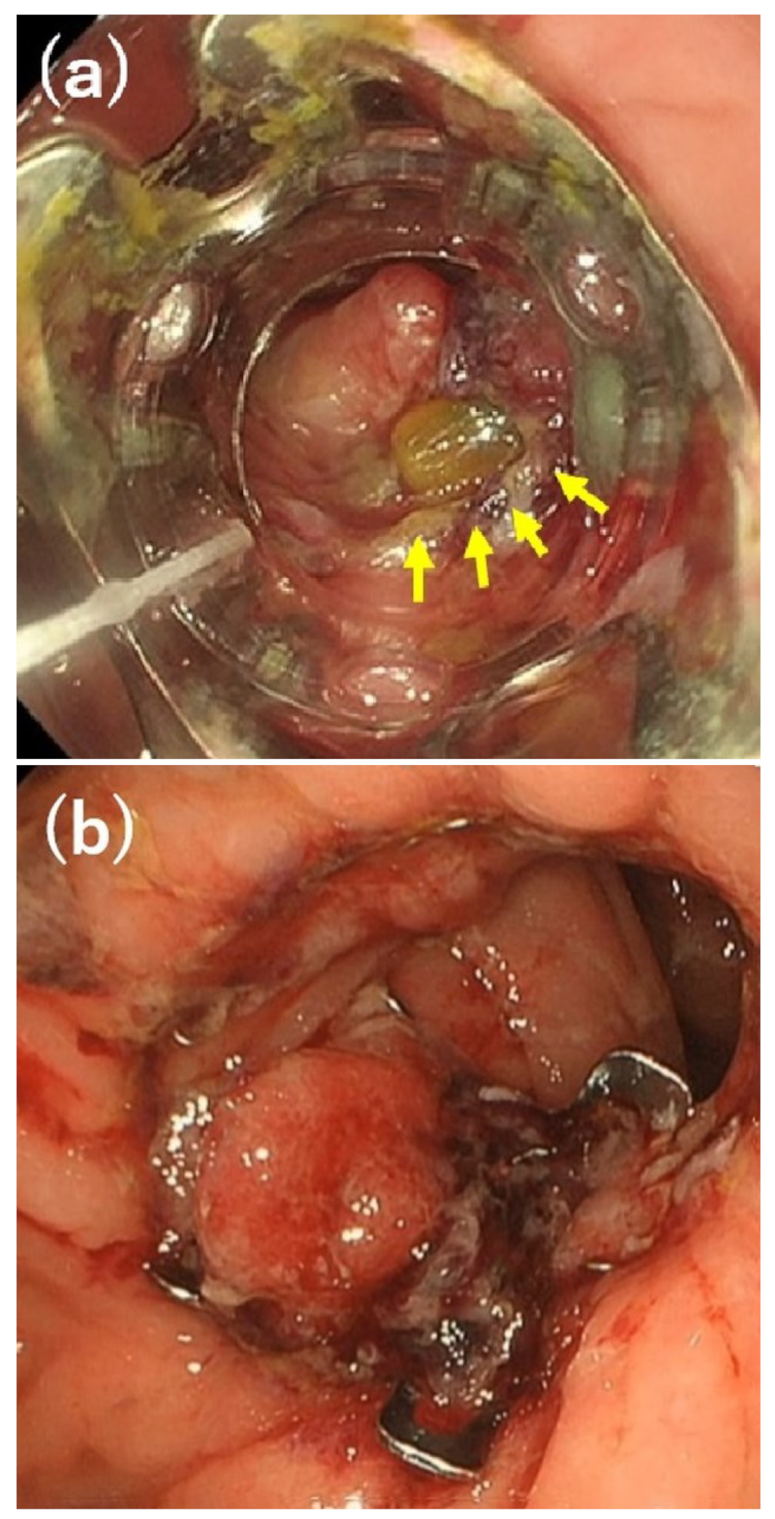 Diagnostics 13 02997 g003 Diagnostics 13 02997 g003