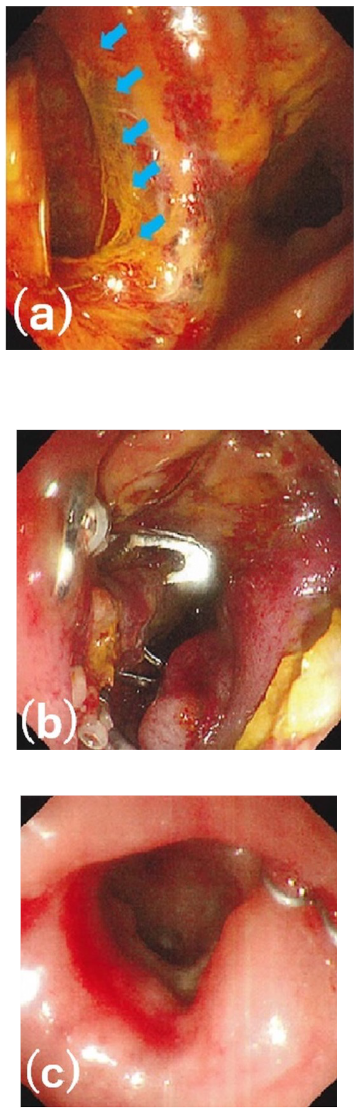 Diagnostics 13 02997 g004 Diagnostics 13 02997 g004