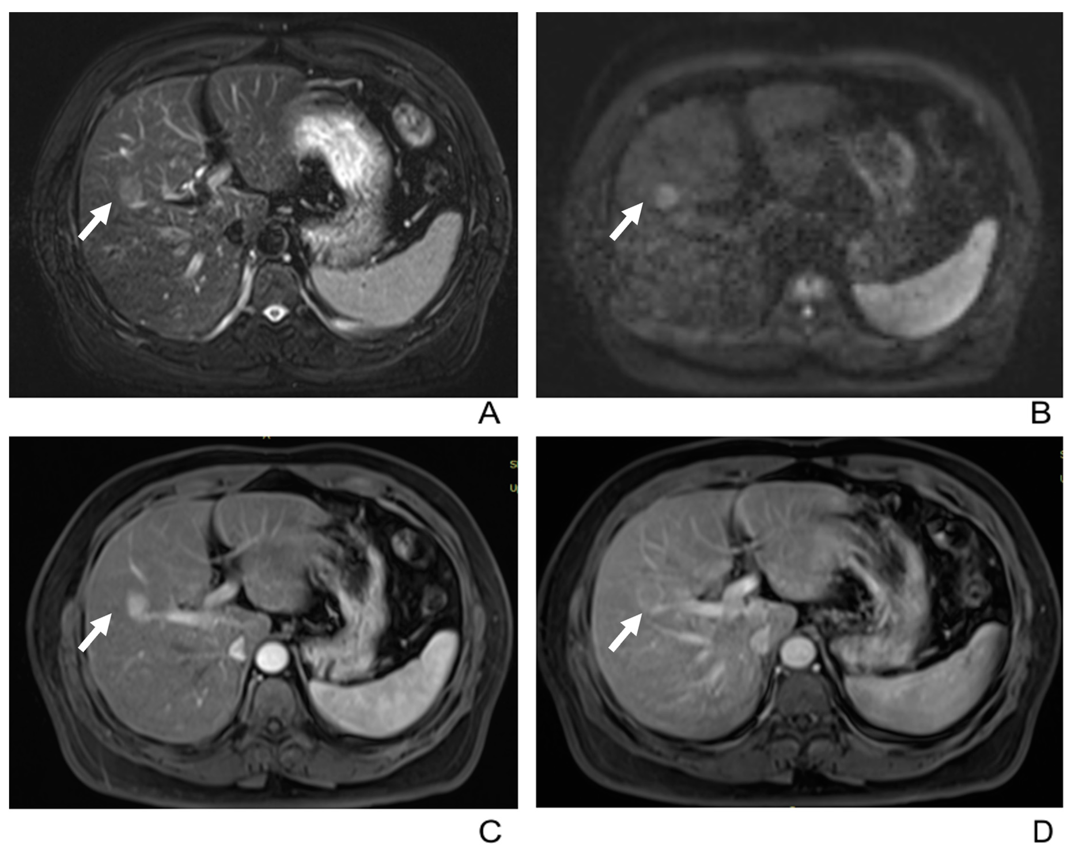 Diagnostics 13 02998 g004
