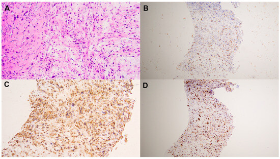 Diagnostics | Free Full-Text | Comparison of 18F-FDG PET/CT and 68Ga ...