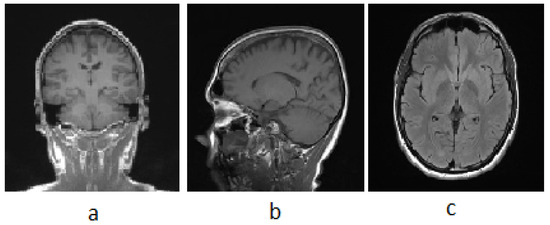 Neuroimaging and deep learning for brain stroke detection - A review of  recent advancements and future prospects - ScienceDirect