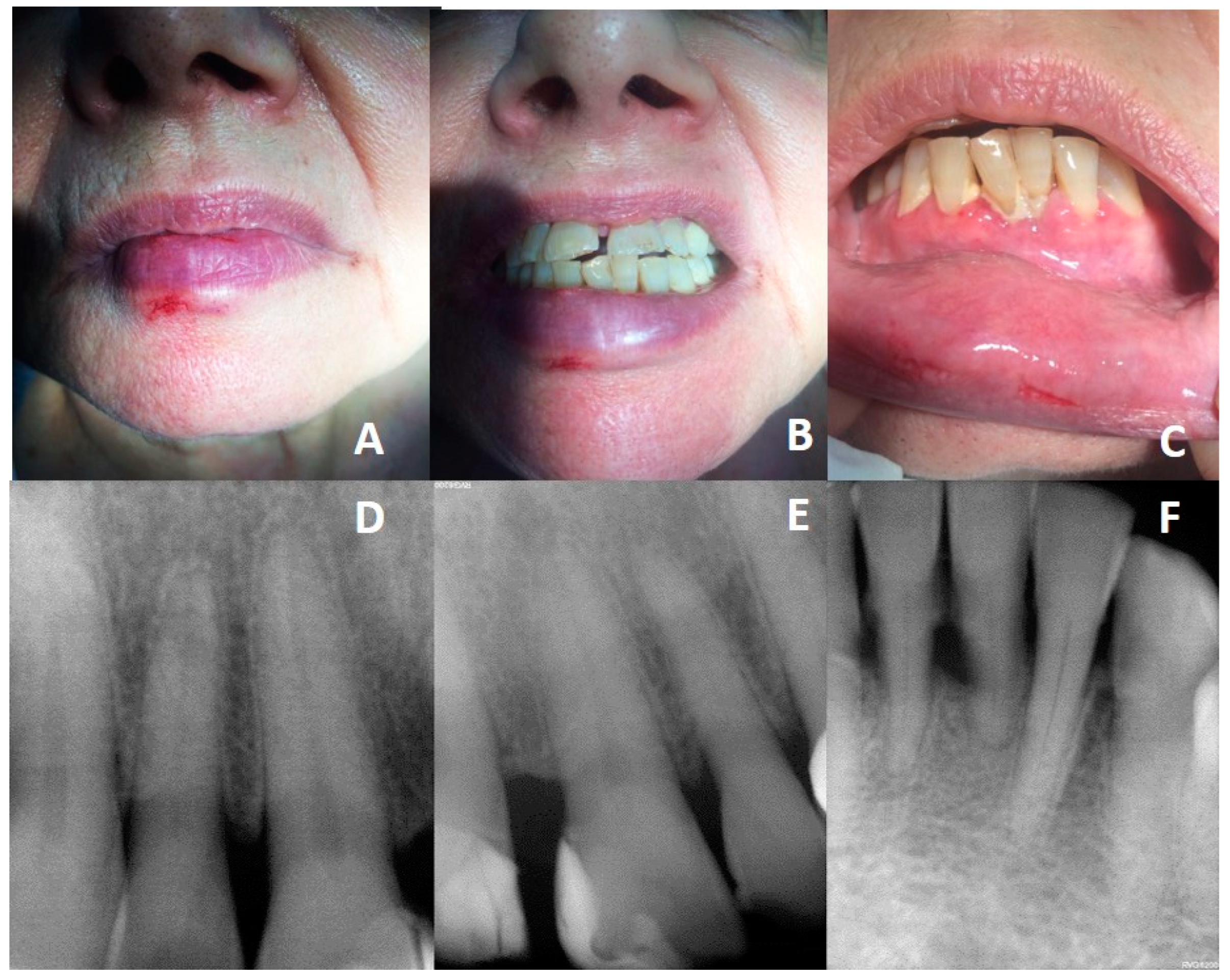 Dental Emergency