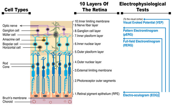 The Value of Electroretinography in Identifying Candidate