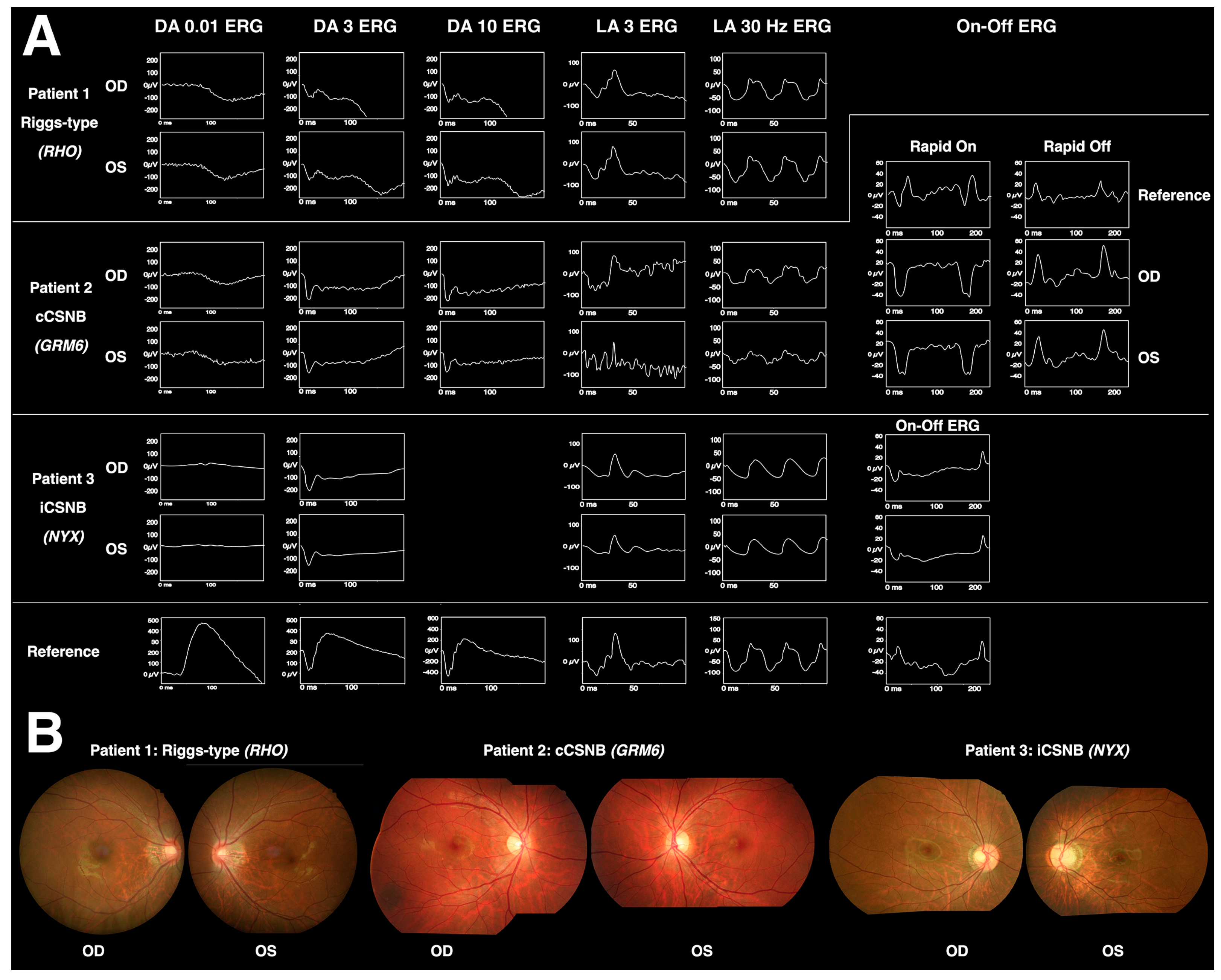 Diagnostics 13 03041 g004 Diagnostics 13 03041 g004