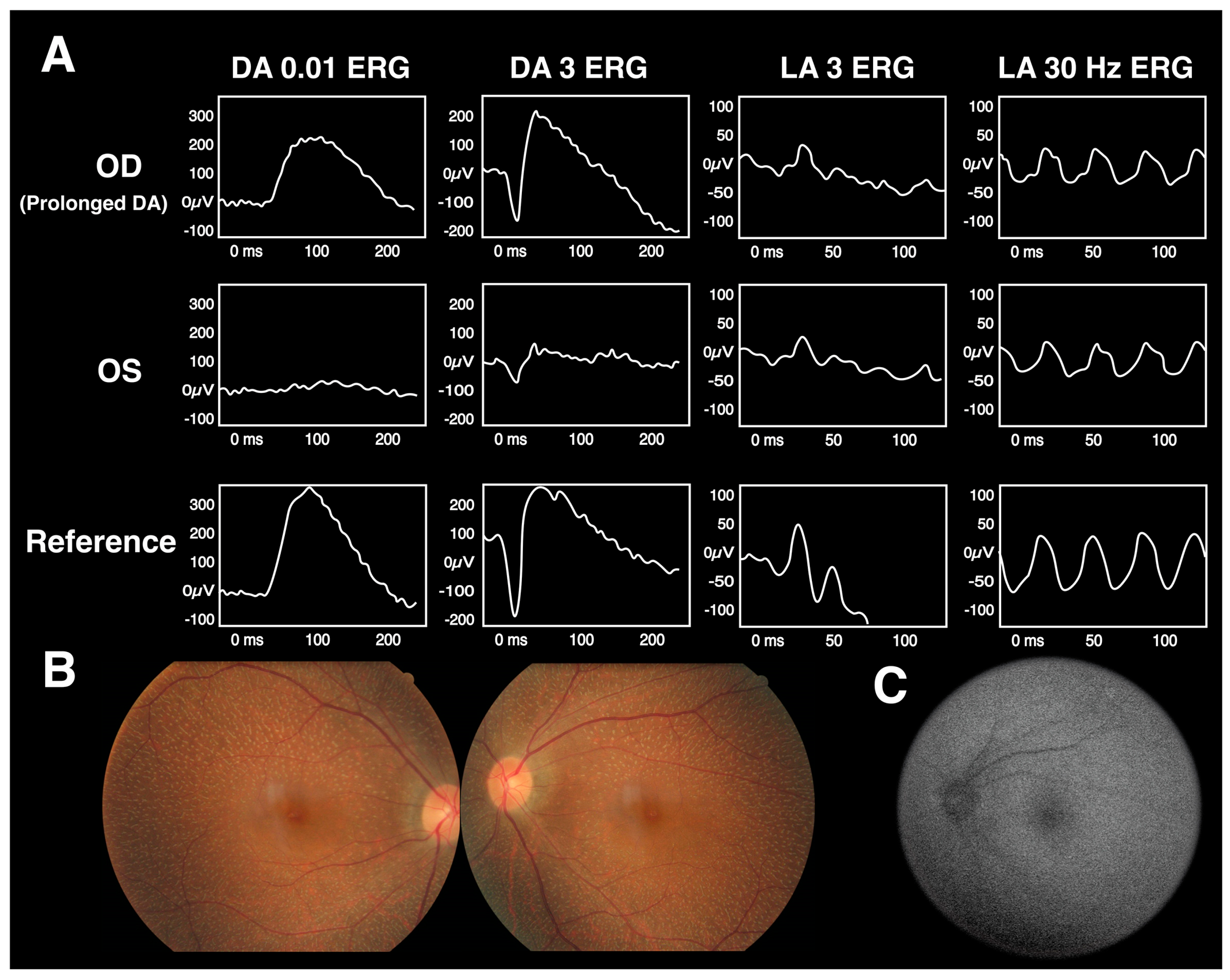 Diagnostics 13 03041 g007 Diagnostics 13 03041 g007
