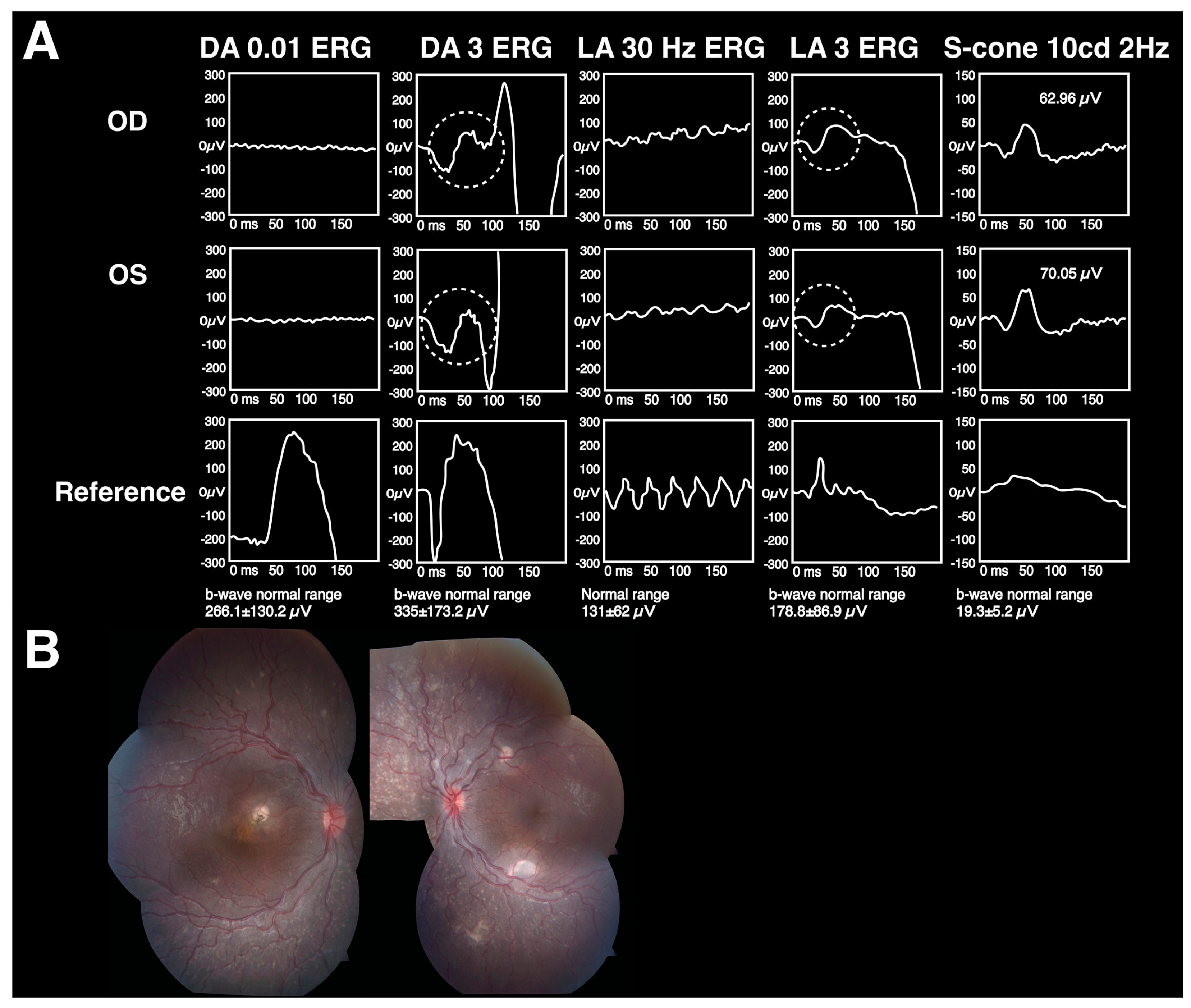 Diagnostics 13 03041 g008 Diagnostics 13 03041 g008
