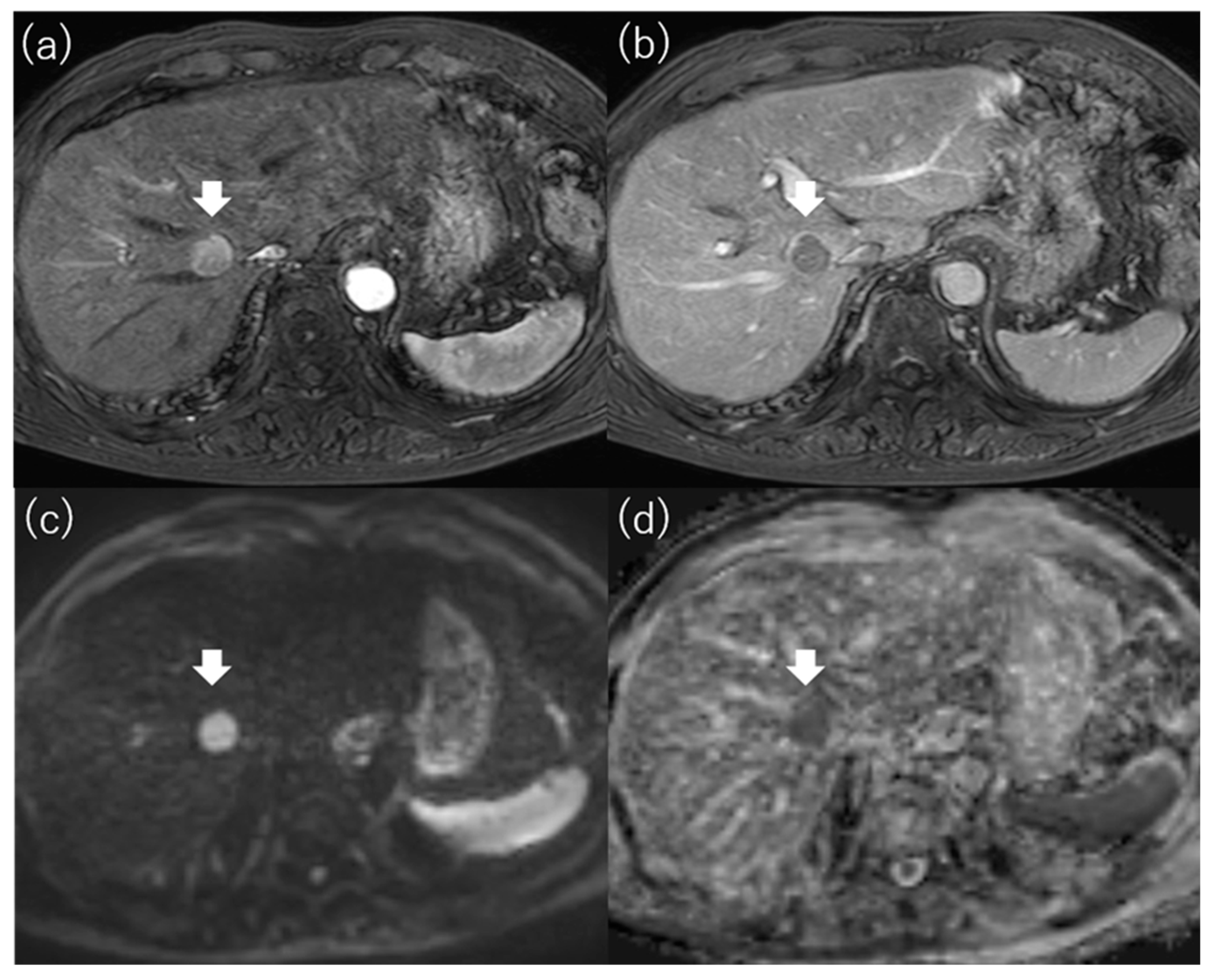Diagnostics 13 03058 g005