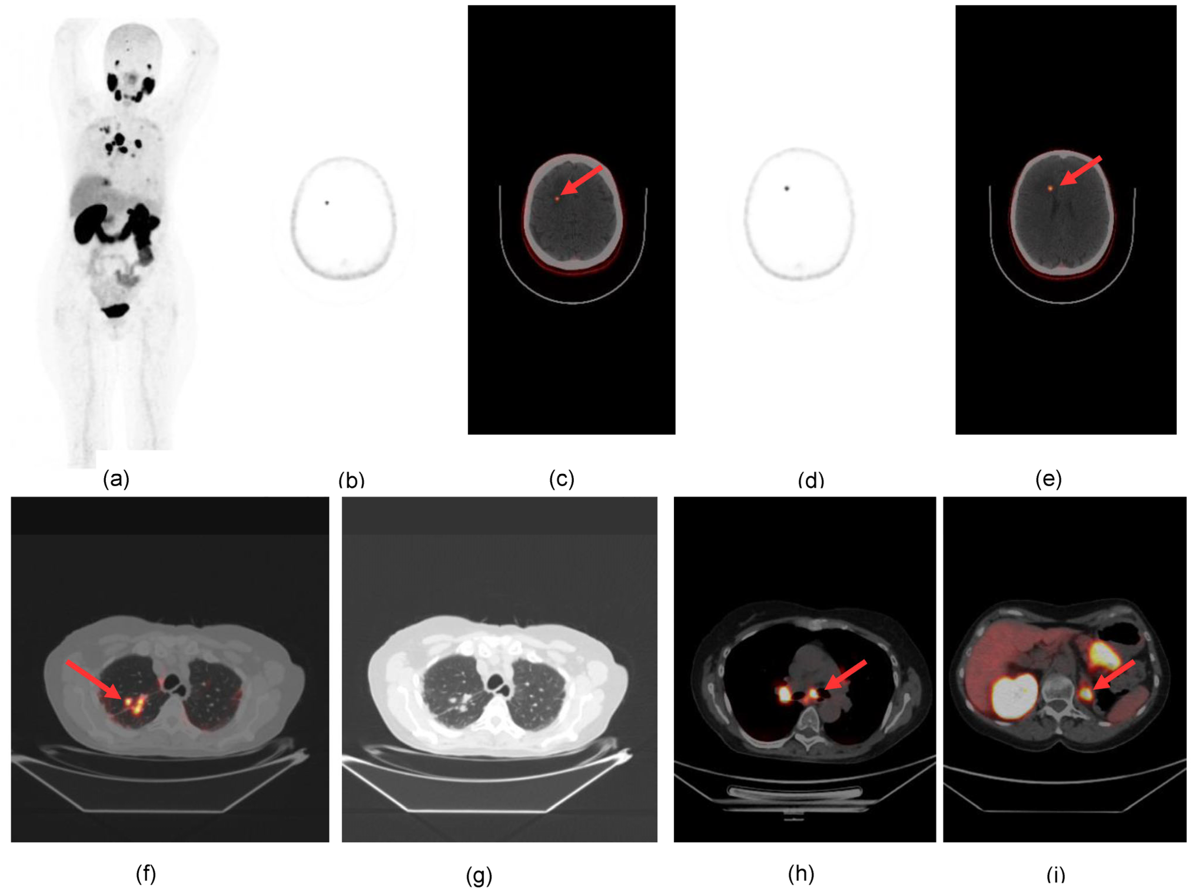 Diagnostics 13 03082 g003
