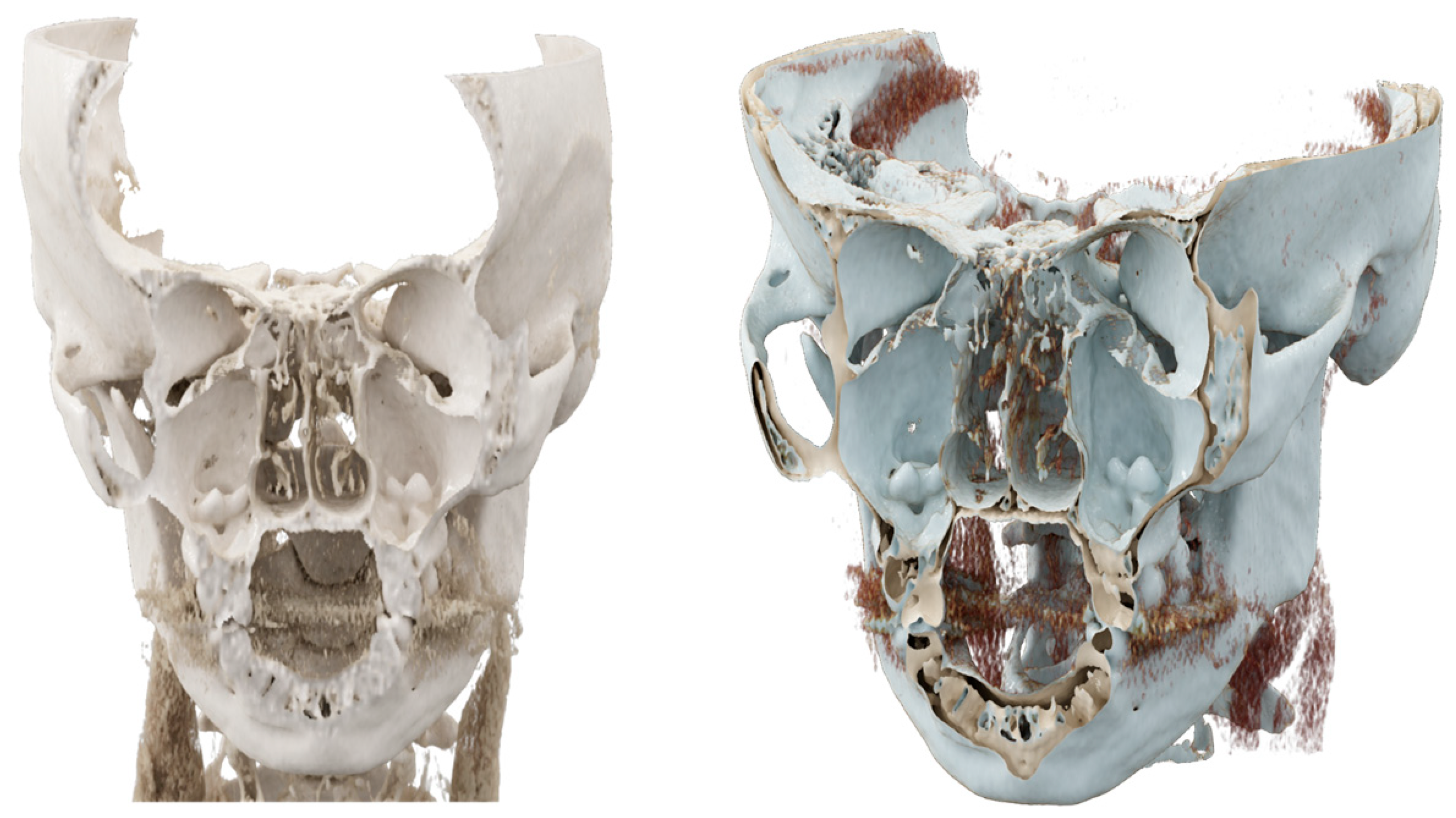 Diagnostics 13 03084 g003