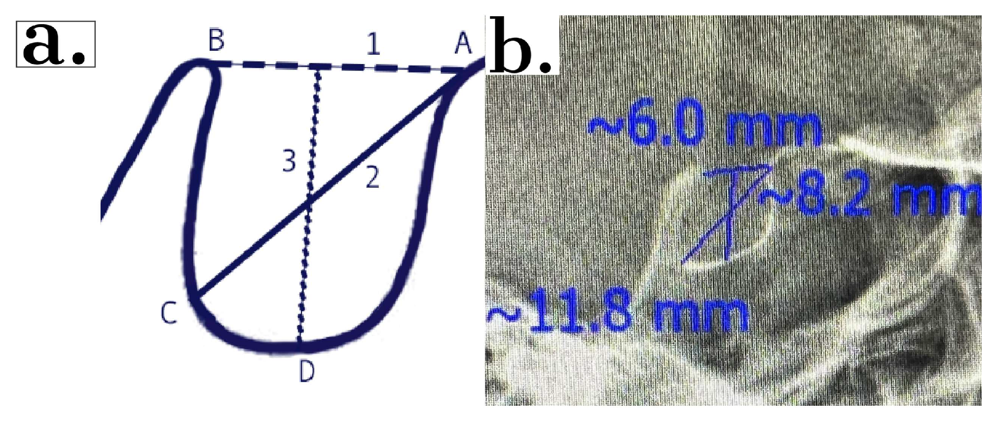 Diagnostics 13 03088 g002 Diagnostics 13 03088 g002