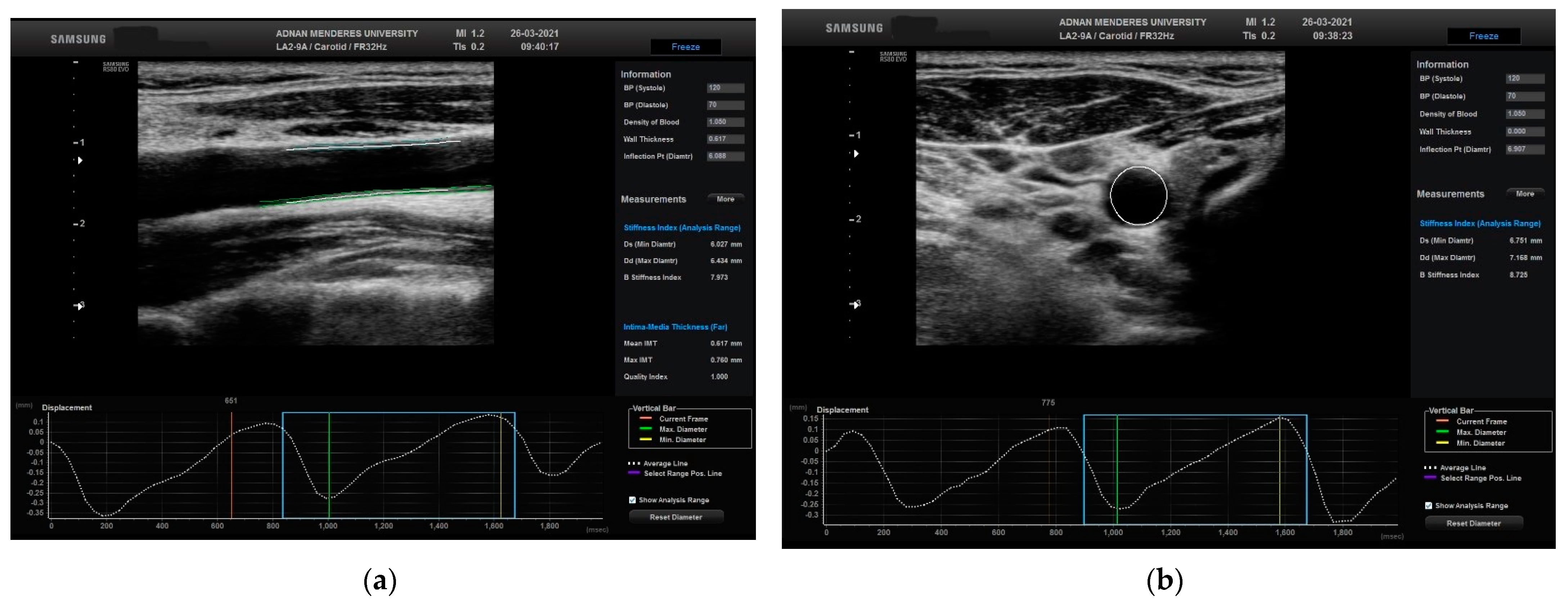 Diagnostics 13 03090 g002