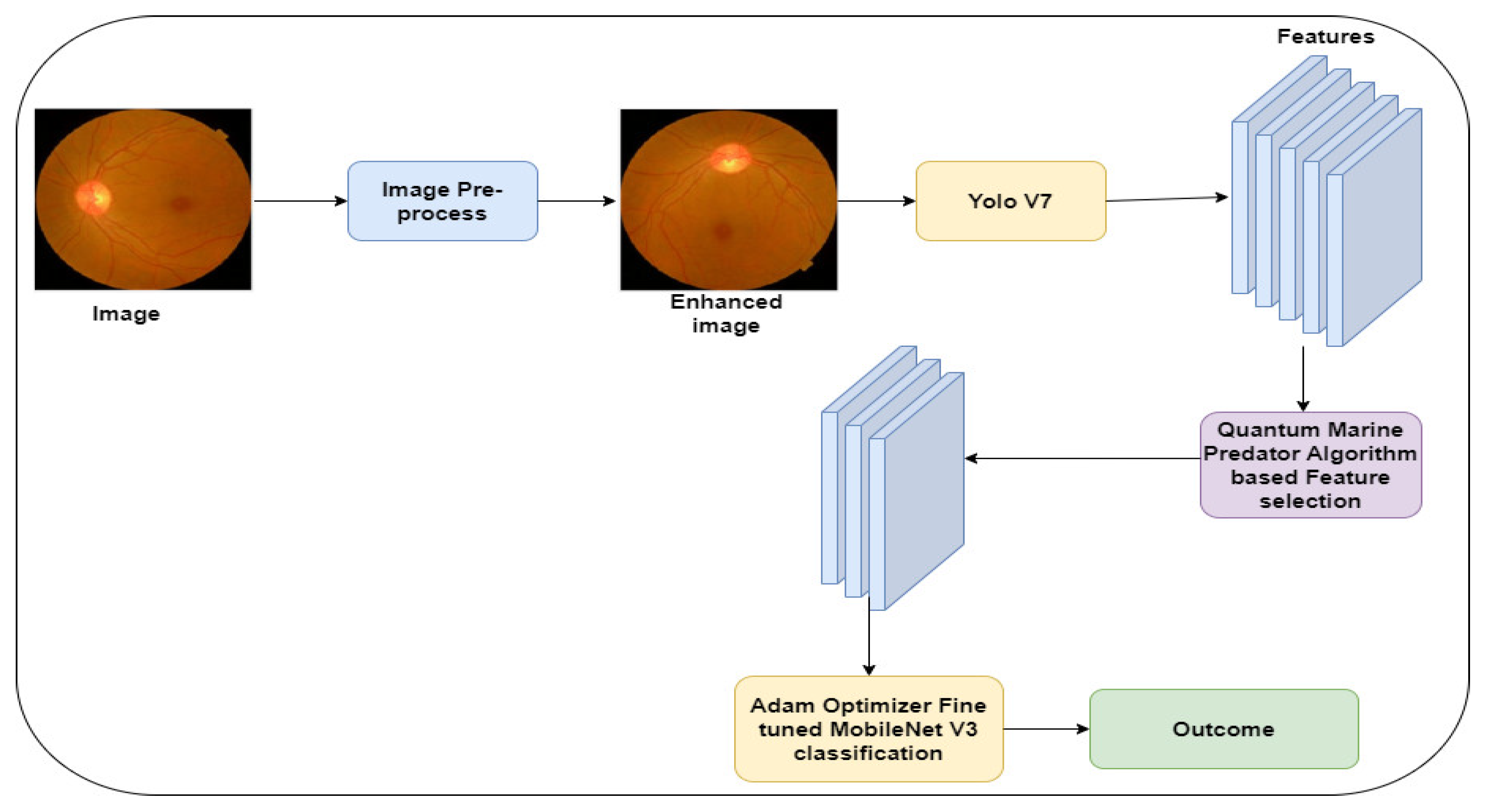 A Lightweight Diabetic Retinopathy Detection Model Using a Deep ...