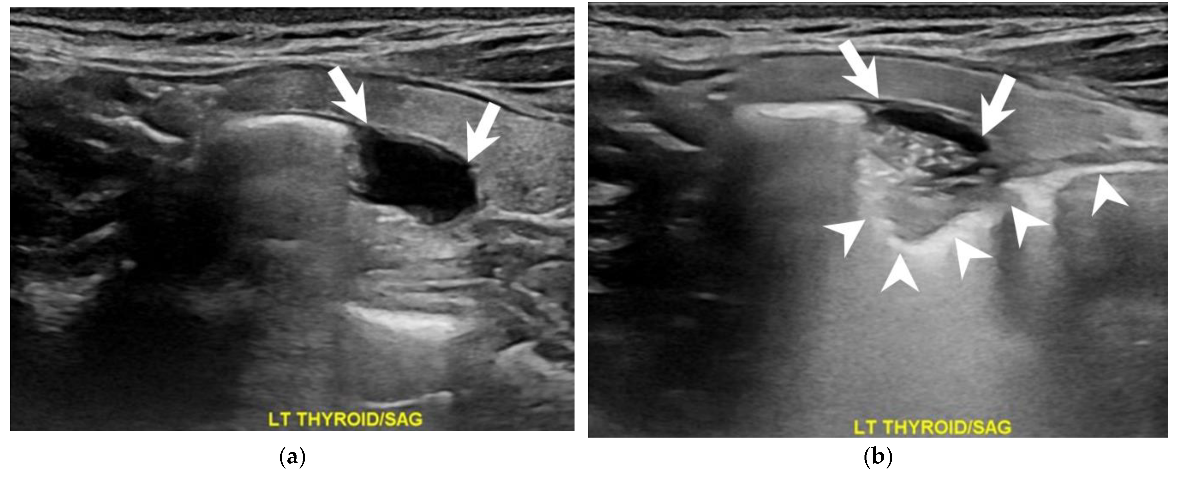 Diagnostics 13 03128 g003 Diagnostics 13 03128 g003