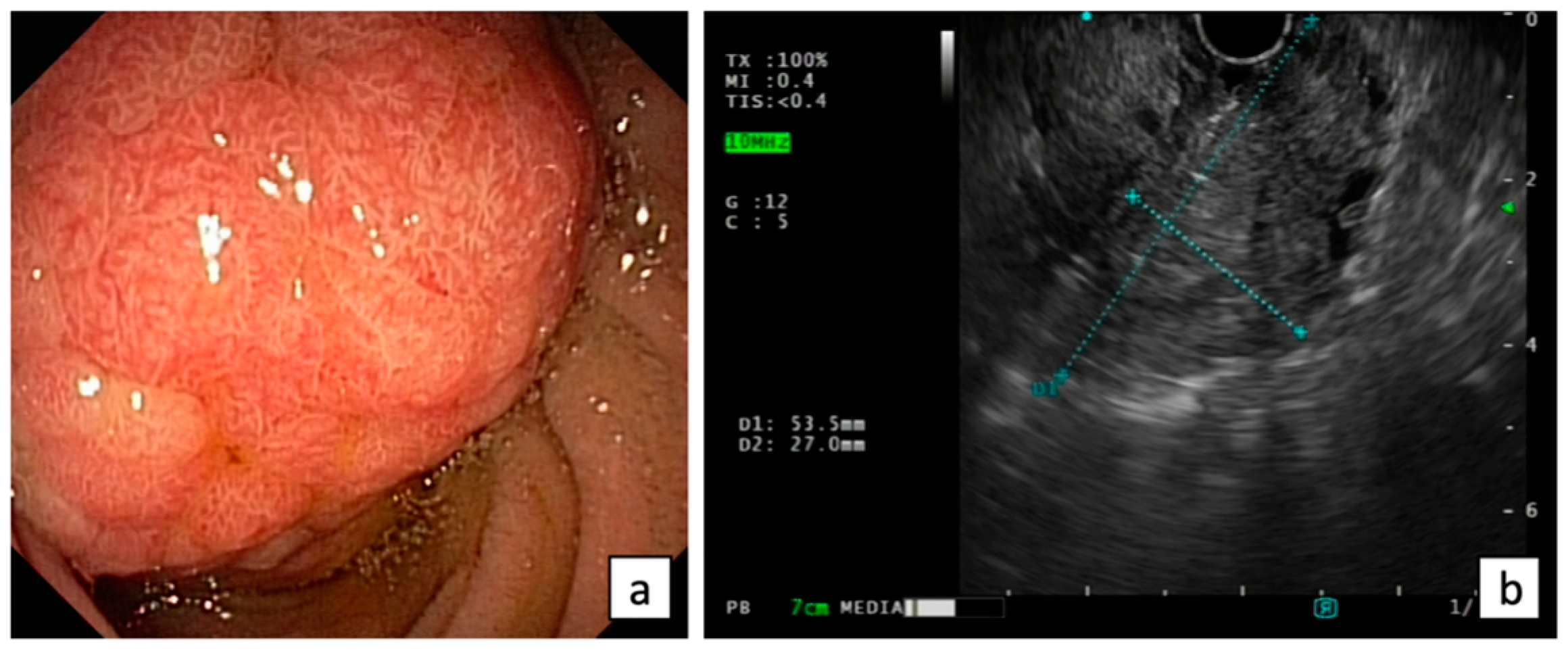 Diagnostics 13 03138 g001