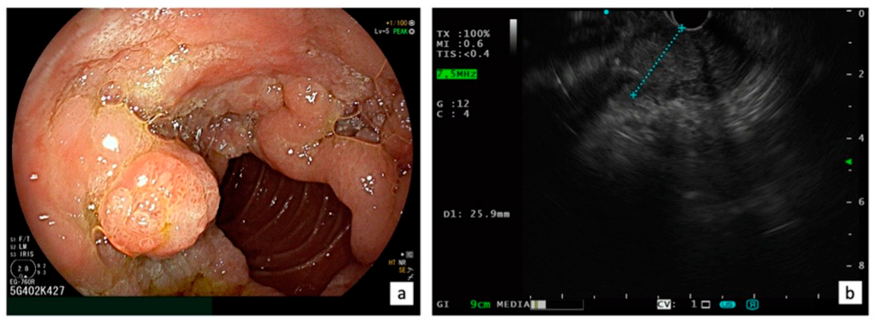 Diagnostics 13 03138 g003