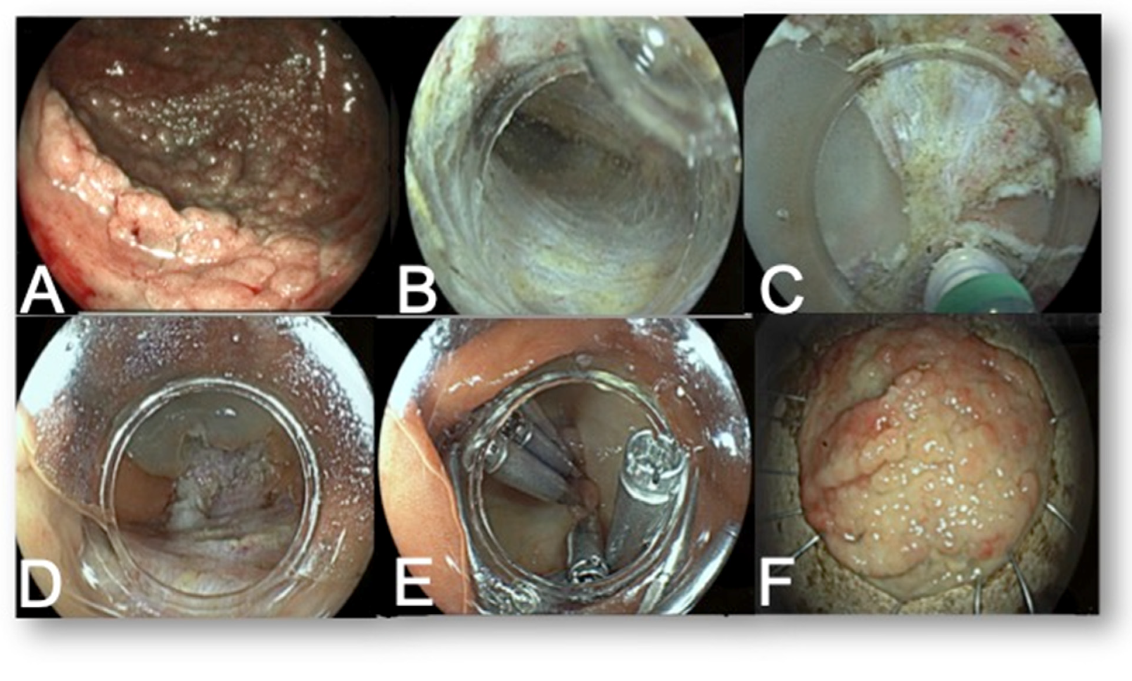 Diagnostics 13 03154 g004