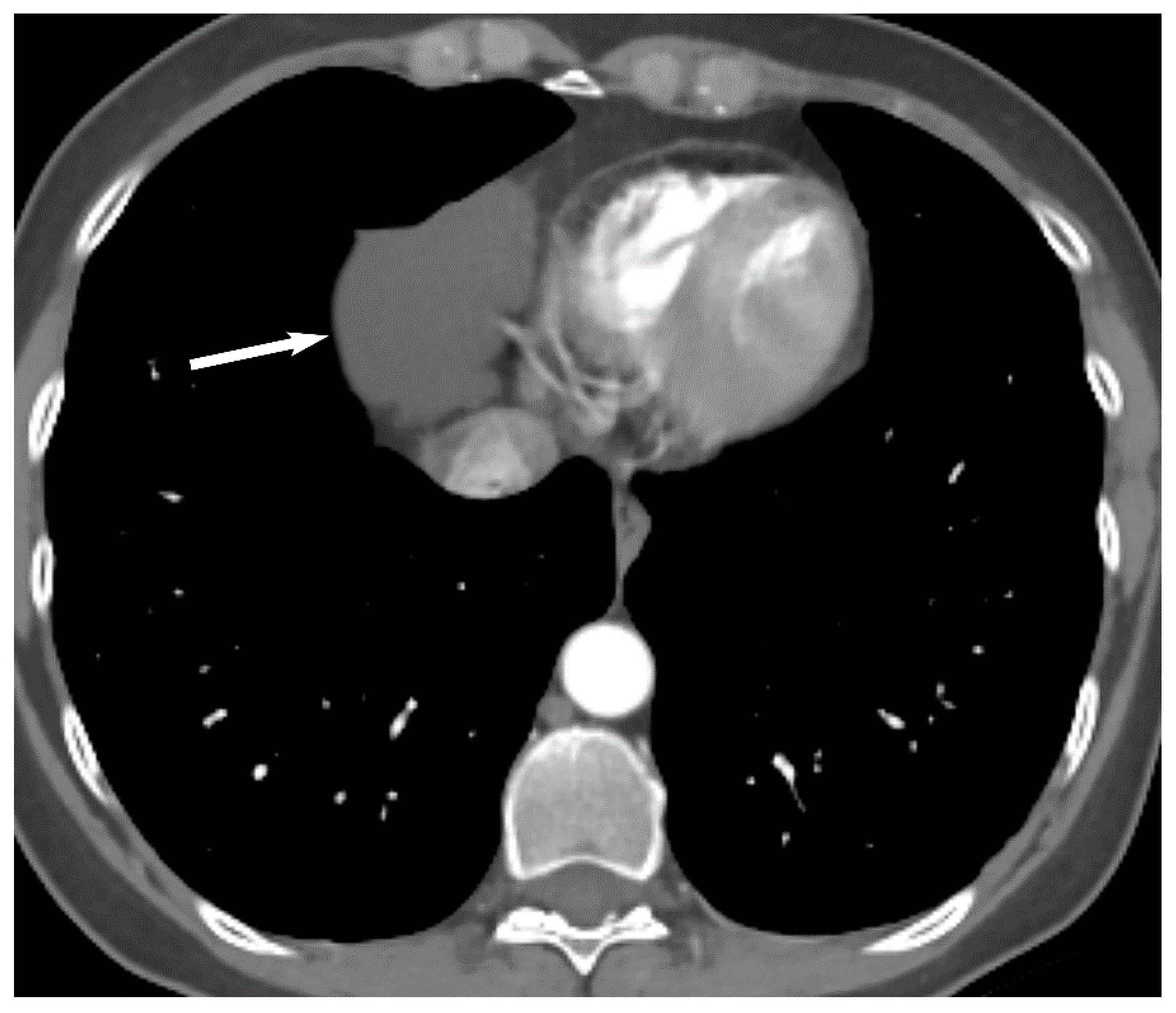 Diagnostics 13 03171 g004