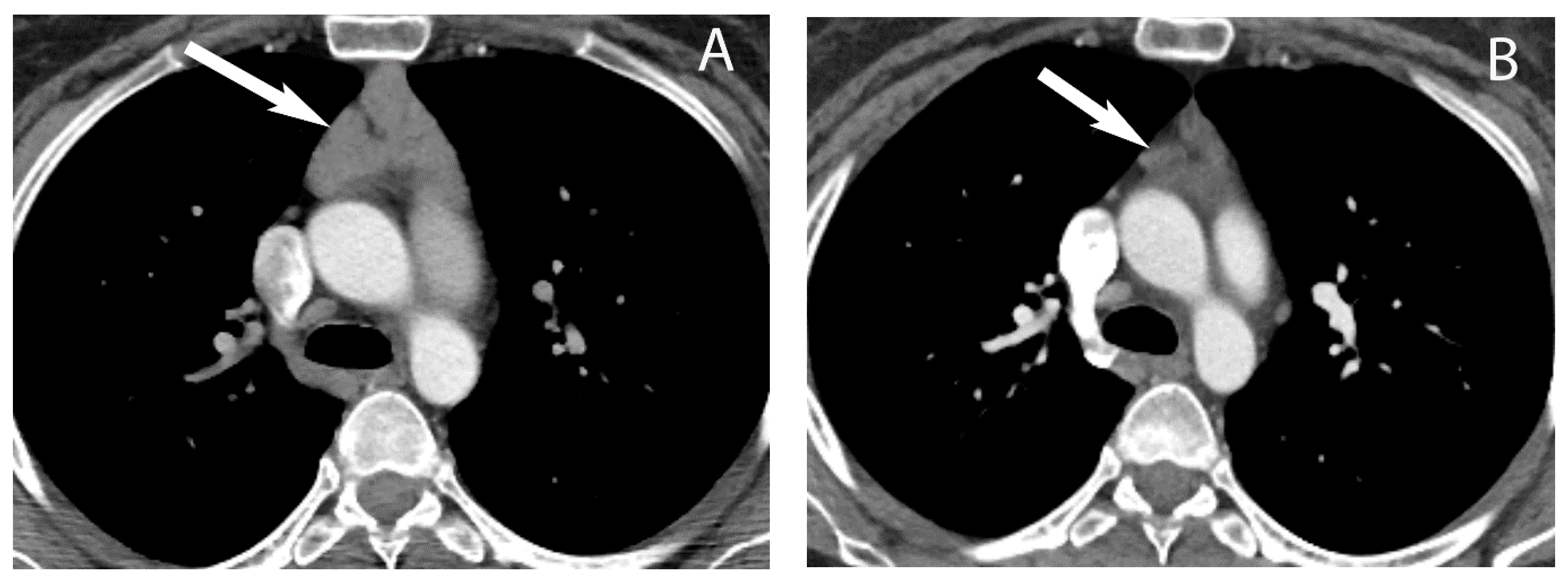 Diagnostics 13 03171 g007