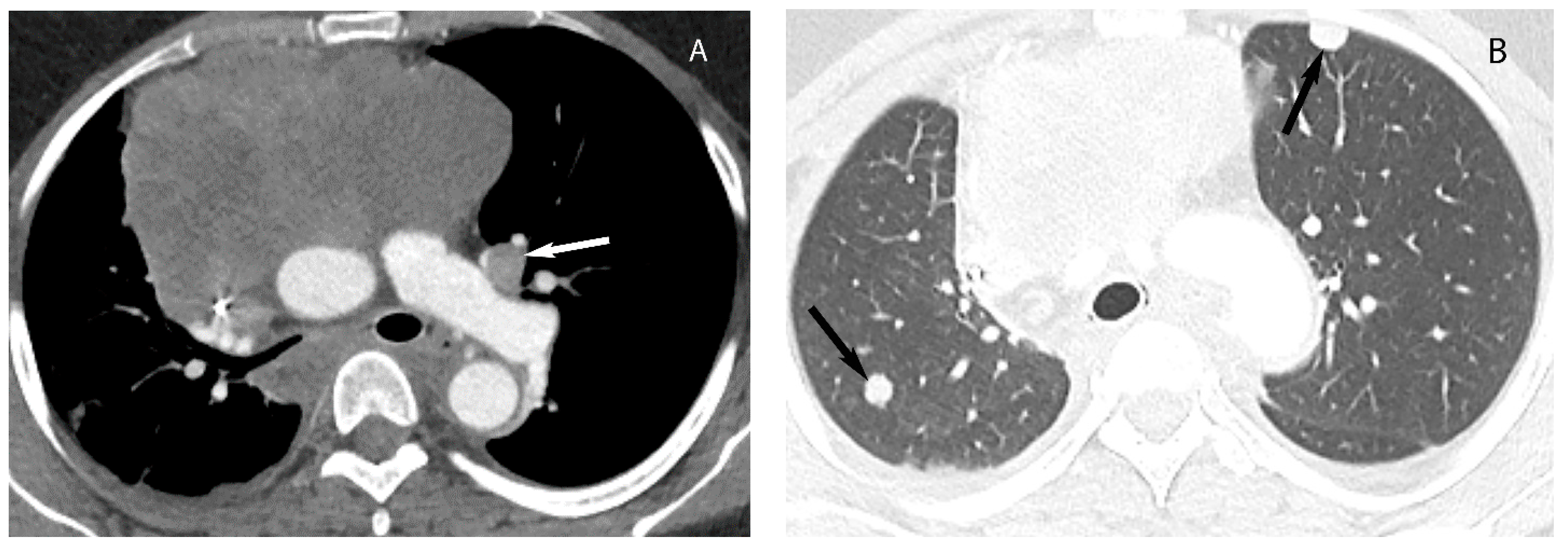 Diagnostics 13 03171 g011