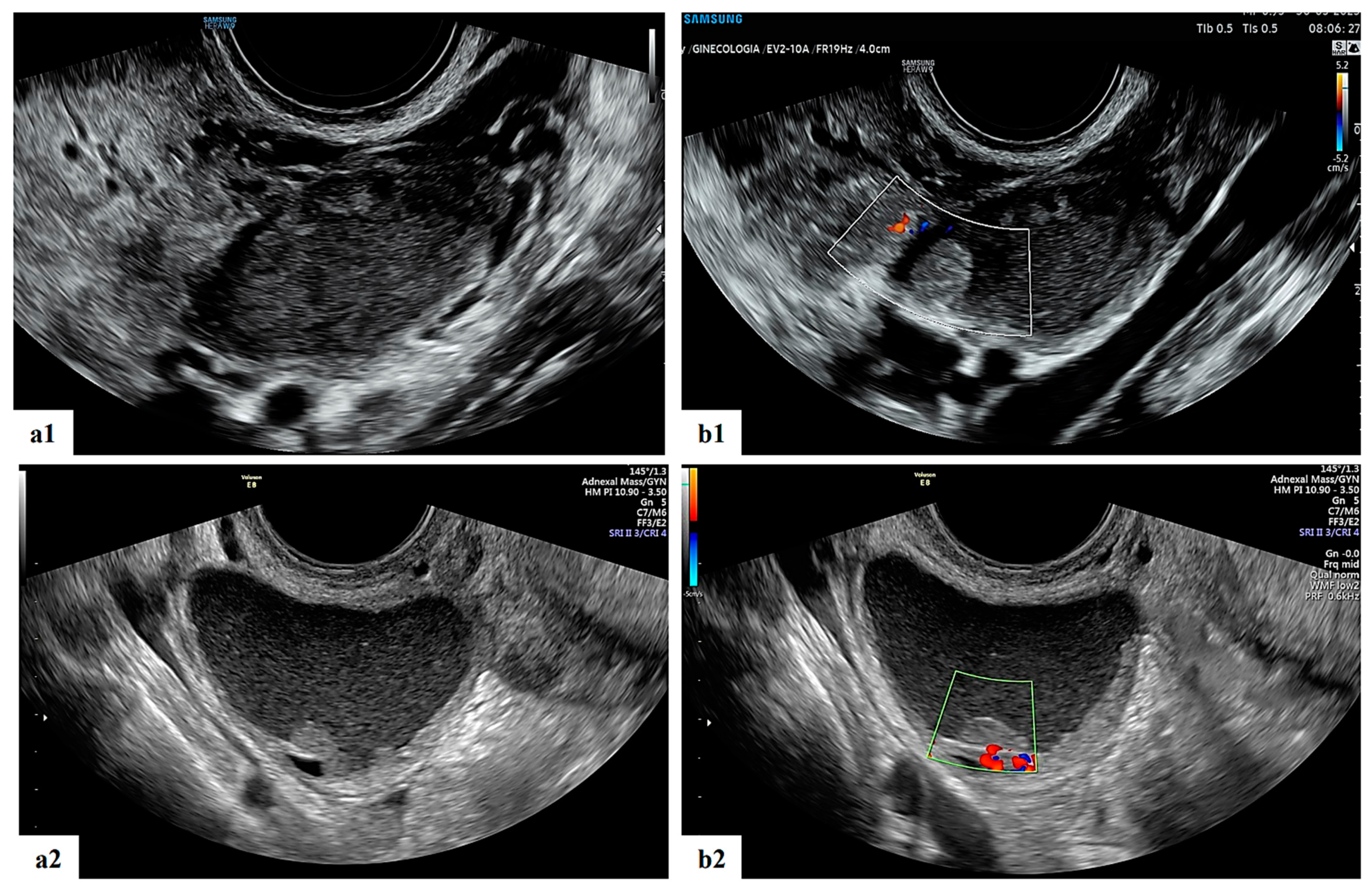 Diagnostics 13 03247 g004