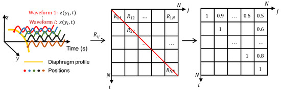 Respiratory Diaphragm Motion-Based Asynchronization and Limitation ...