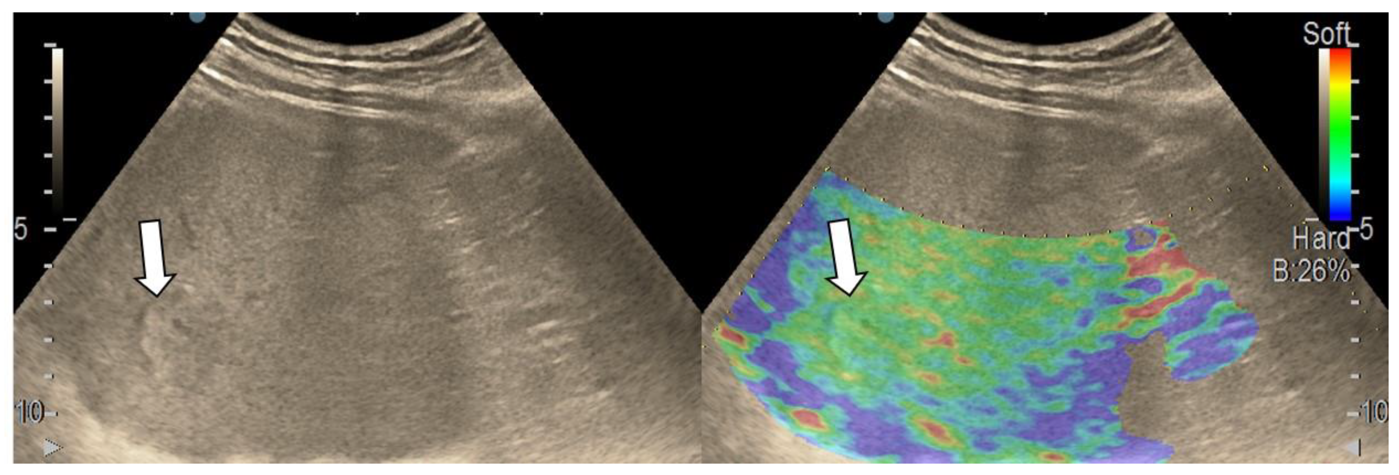 Diagnostics 13 03288 g002
