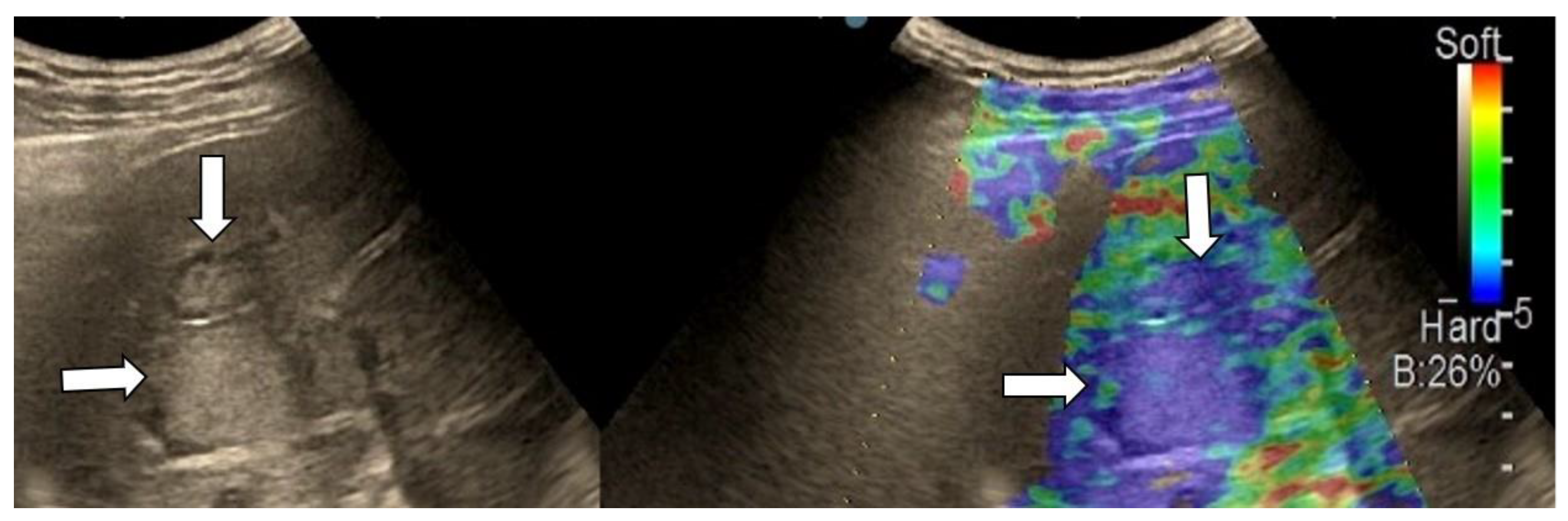 Diagnostics 13 03288 g006