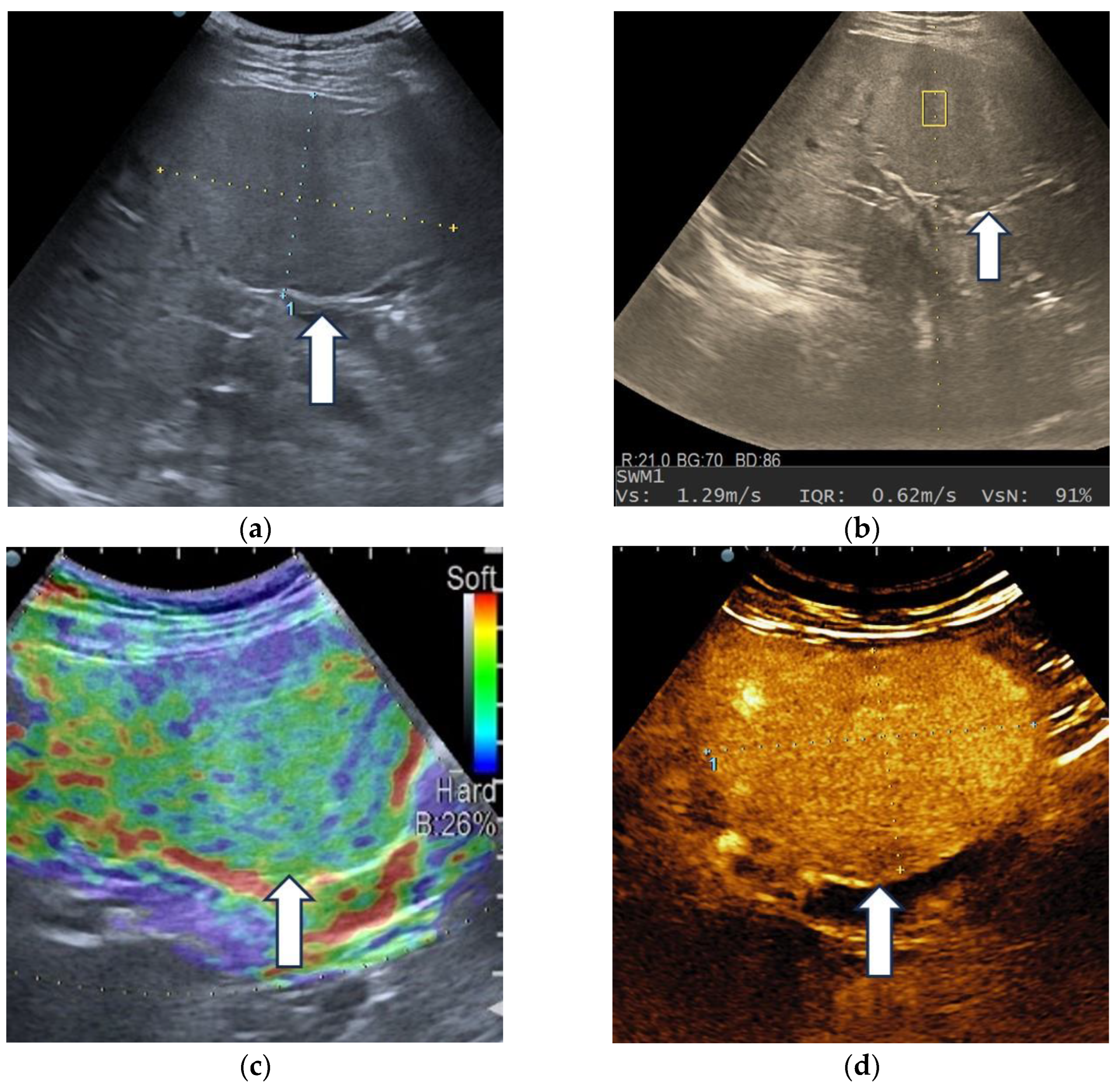 Diagnostics 13 03288 g008a