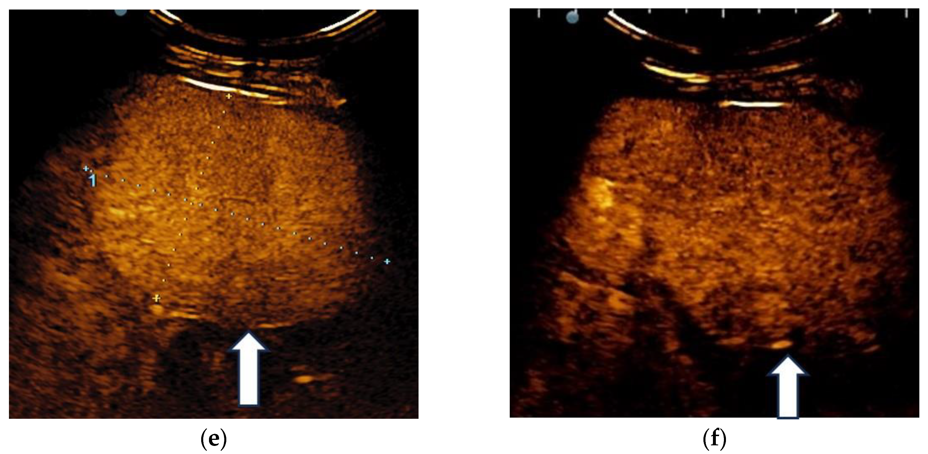 Diagnostics 13 03288 g008b