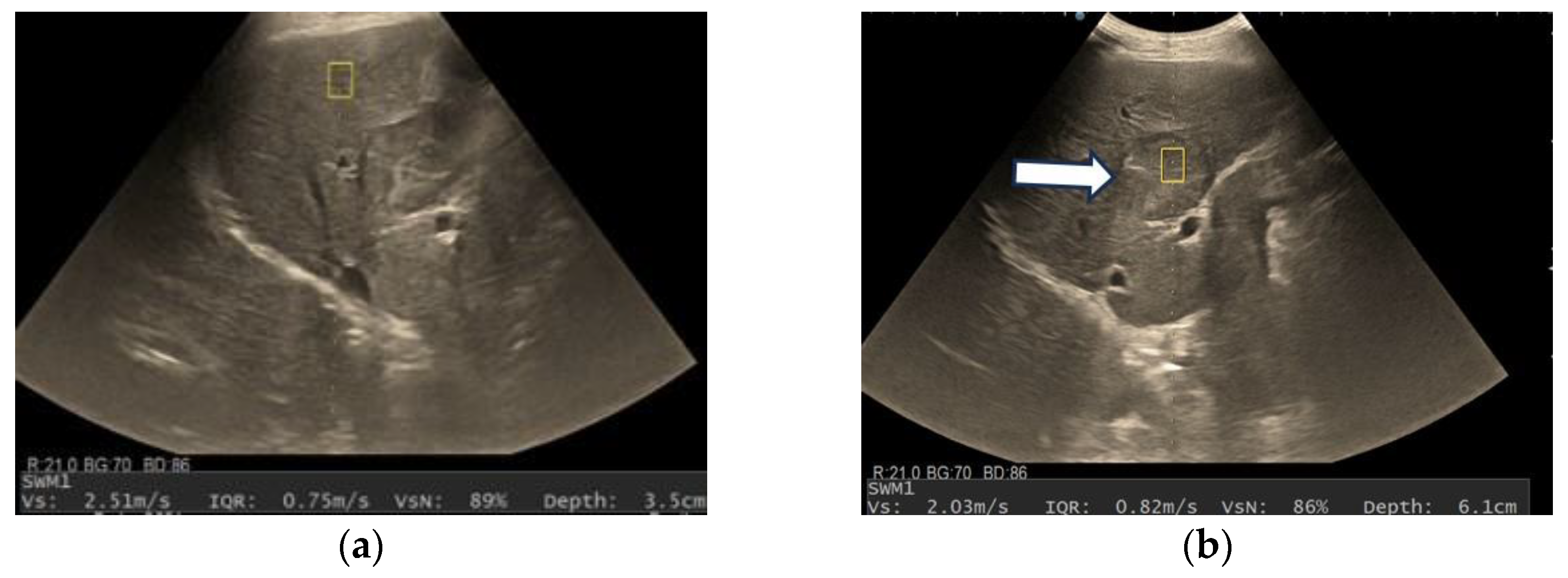 Diagnostics 13 03288 g009a