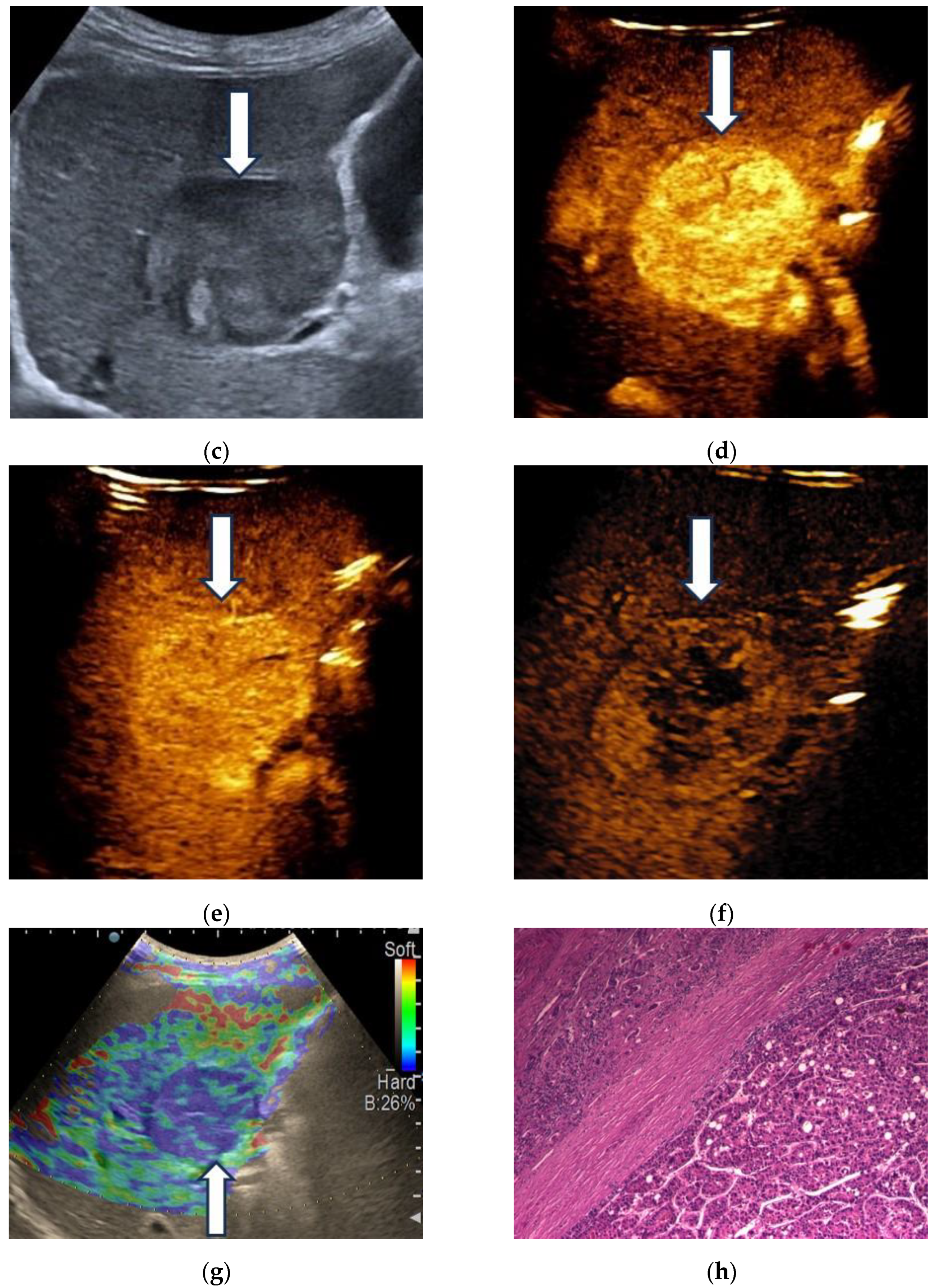 Diagnostics 13 03288 g009b