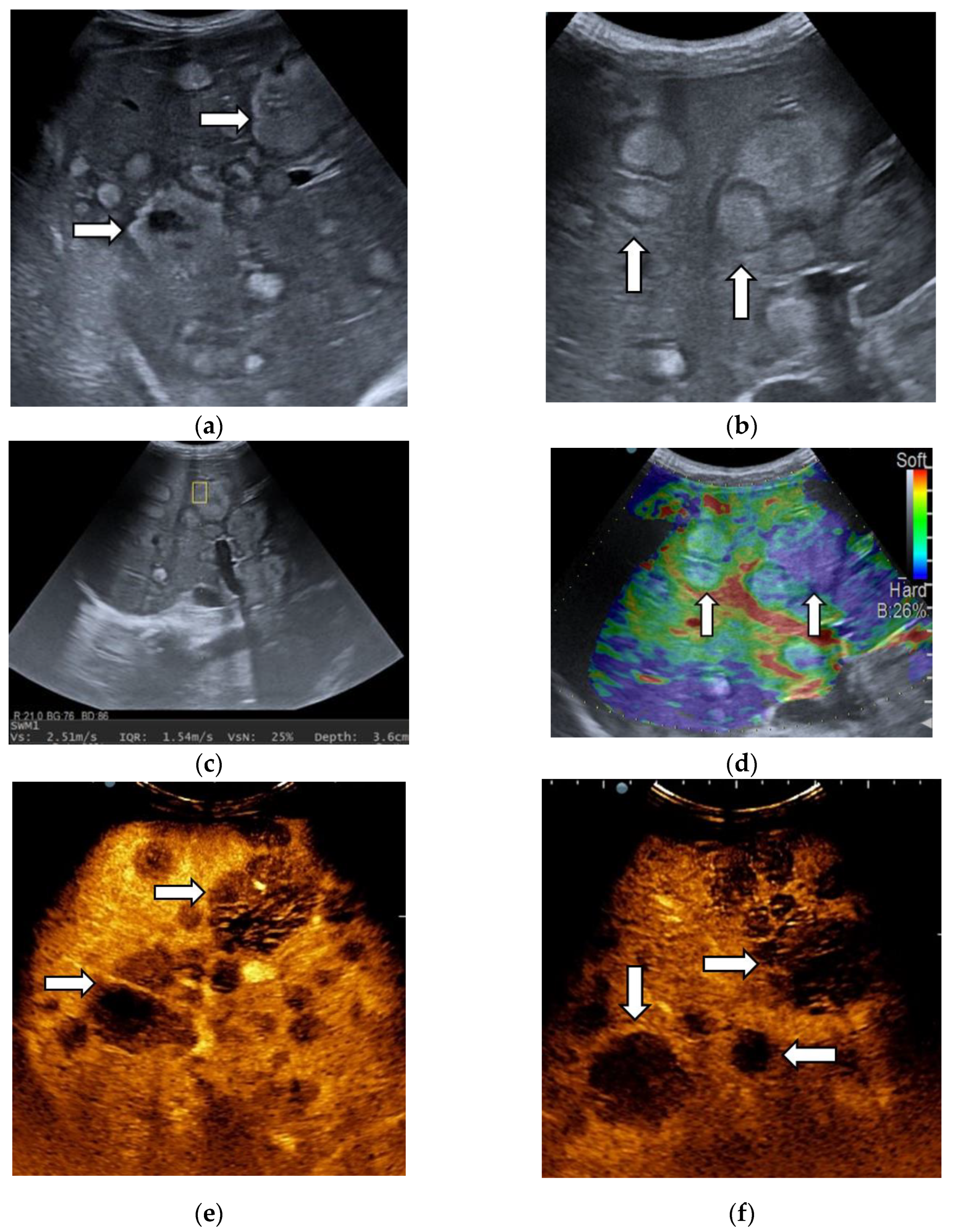 Diagnostics 13 03288 g010