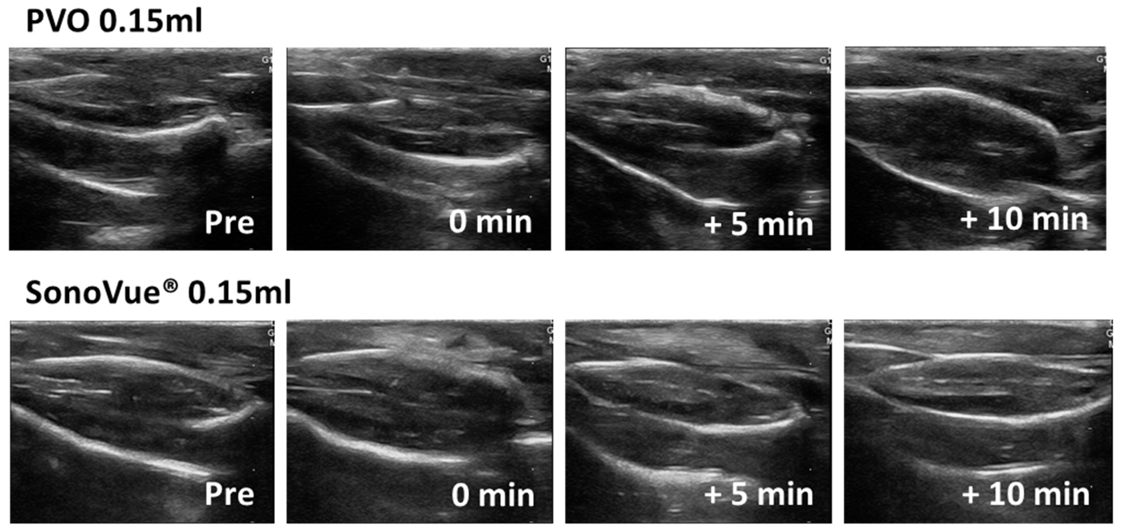 Diagnostics Free FullText Comparison of Ultrasound Contrast
