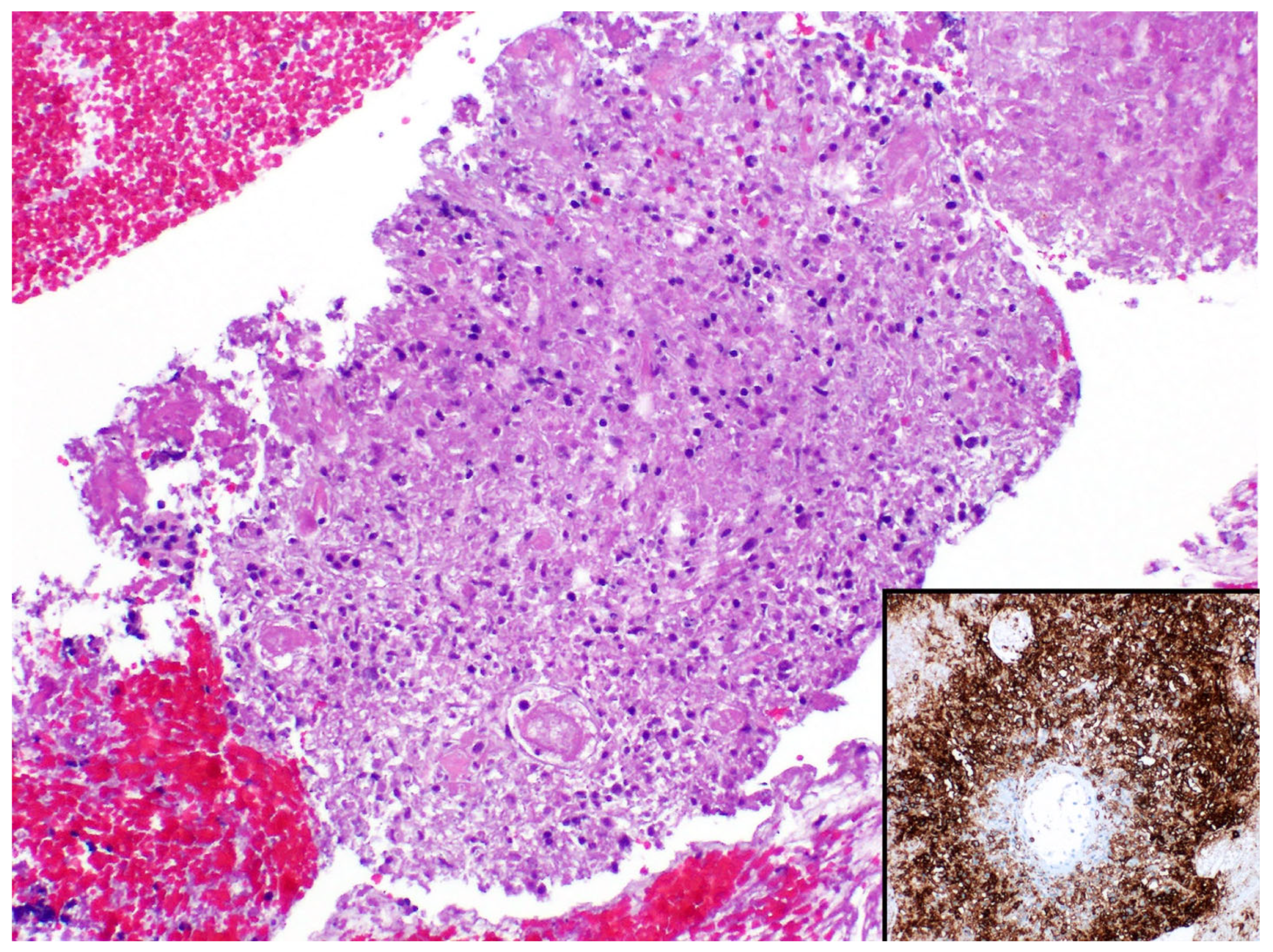 Diagnostics 13 03321 g017