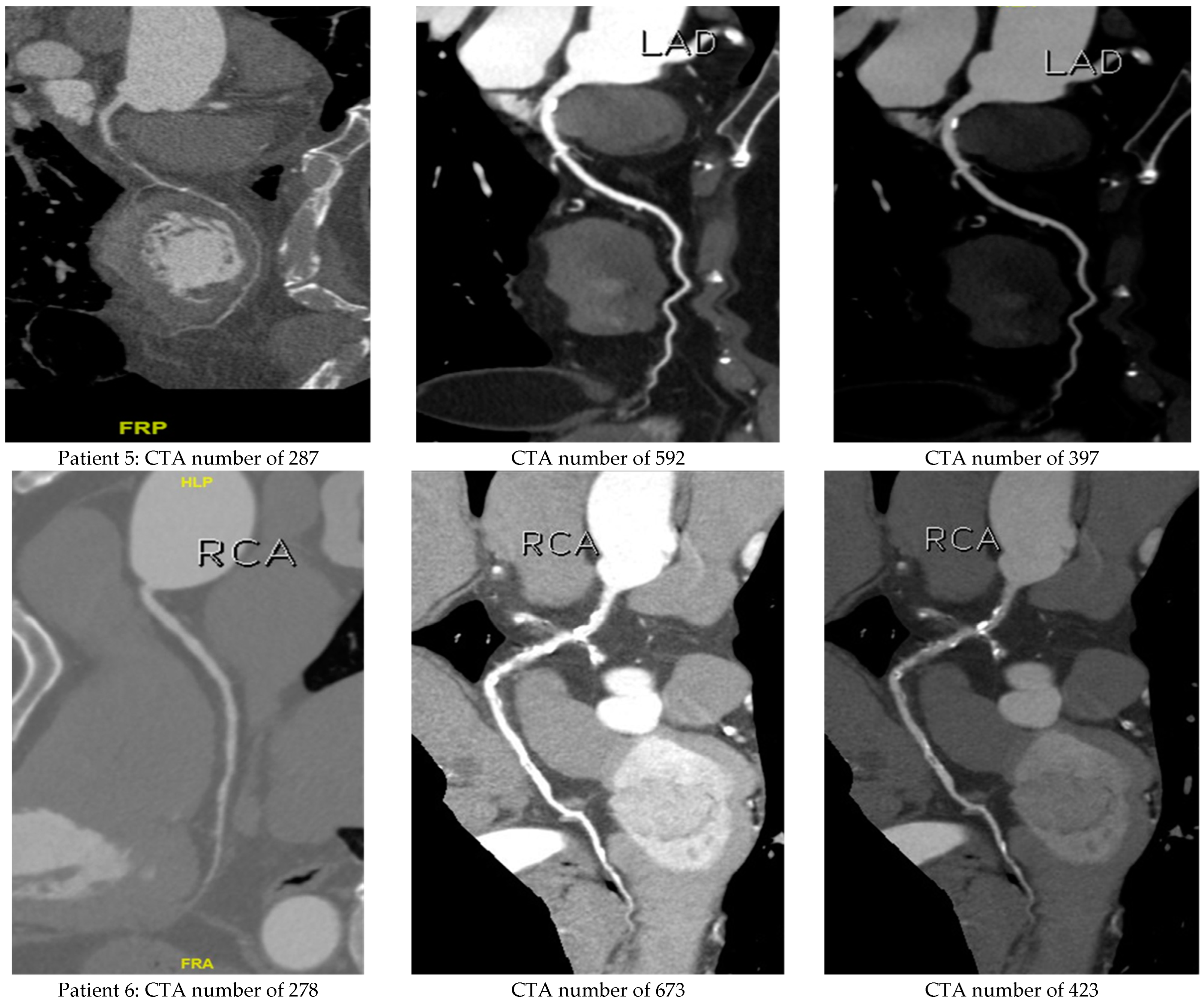 Diagnostics 13 03354 g005b