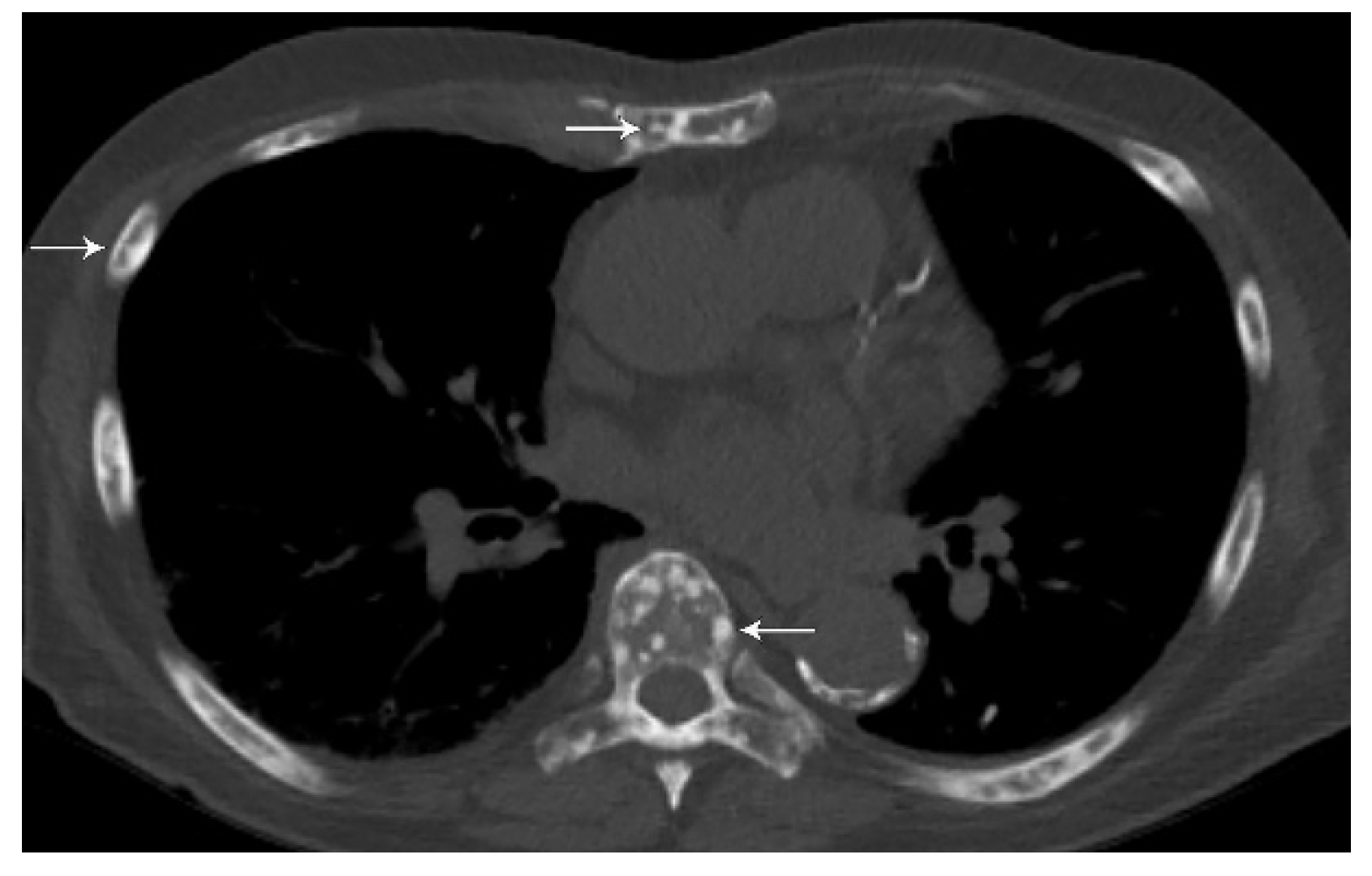 Diagnostics 13 03359 g012