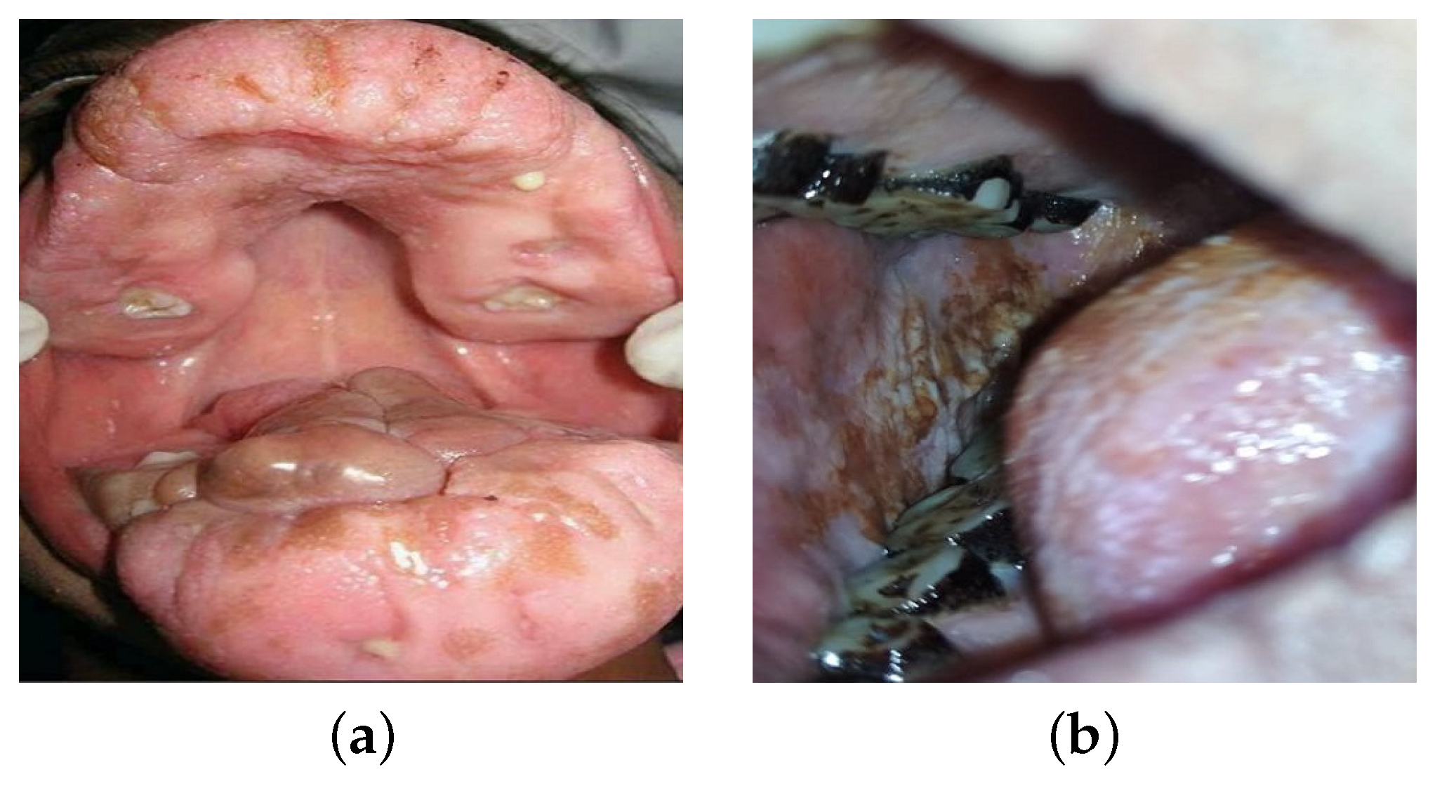 Diagnostics 13 03360 g002
