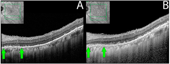Diagnostics | Free Full-Text | Structural and Functional Changes 