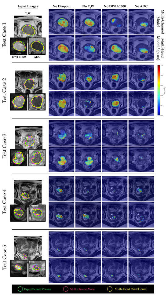 Deep Learning Framework with Multi-Head Dilated Encoders for Enhanced ...